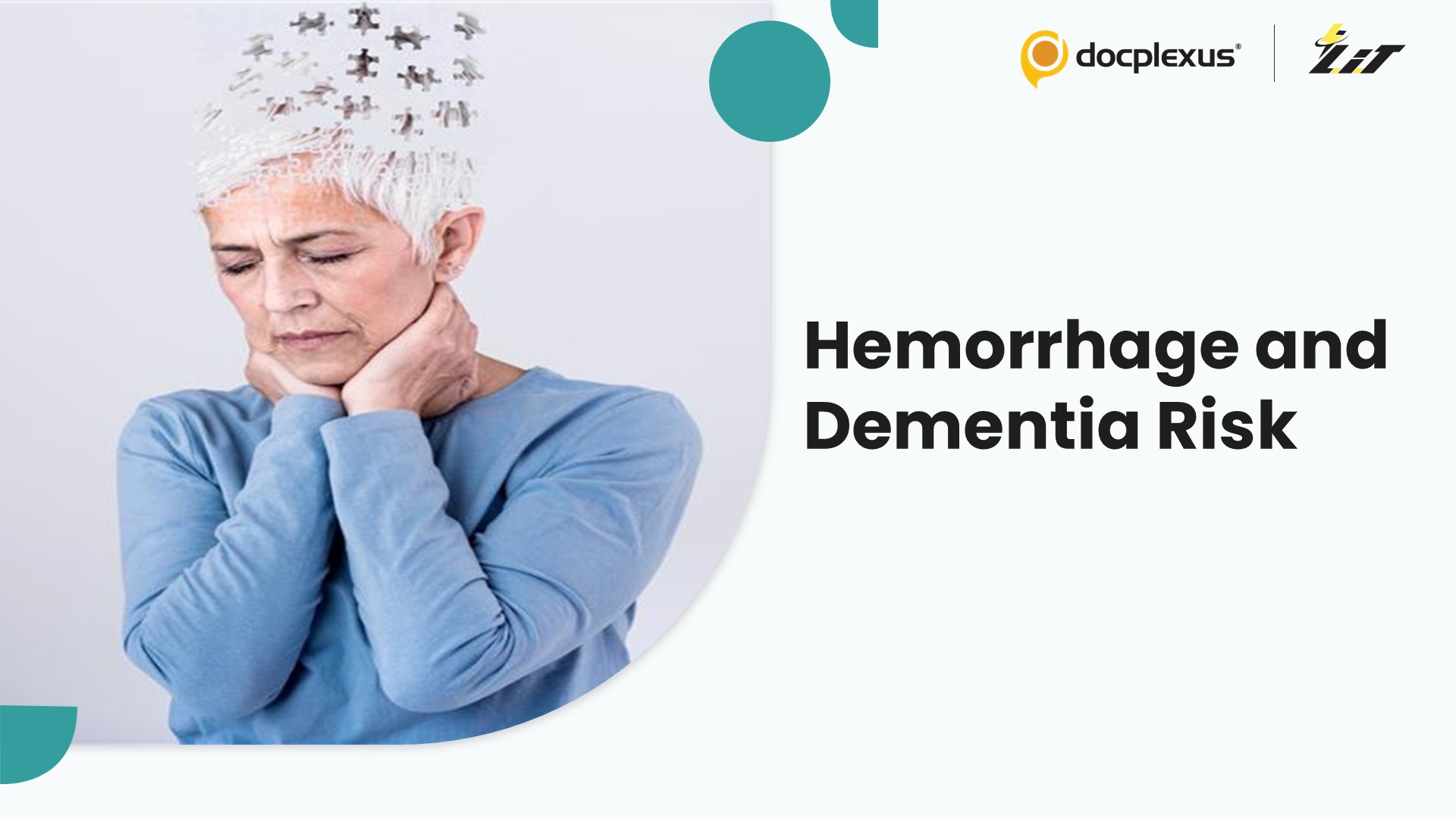 Intracranial Hemorrhages May Increase Dementia Risk