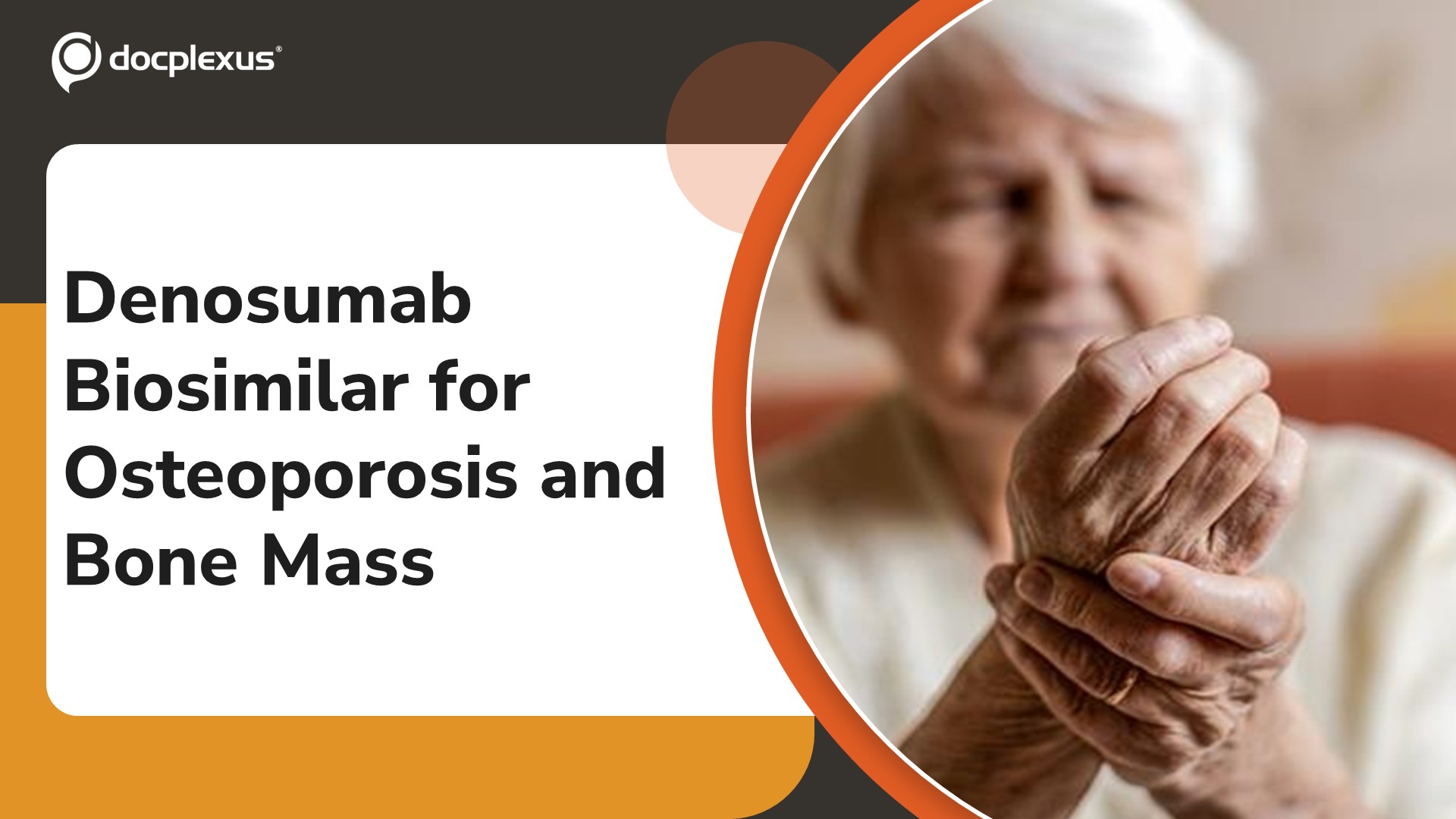 USFDA Approves Denosumab-dssb Biosimilar for Osteoporosis Treatment
