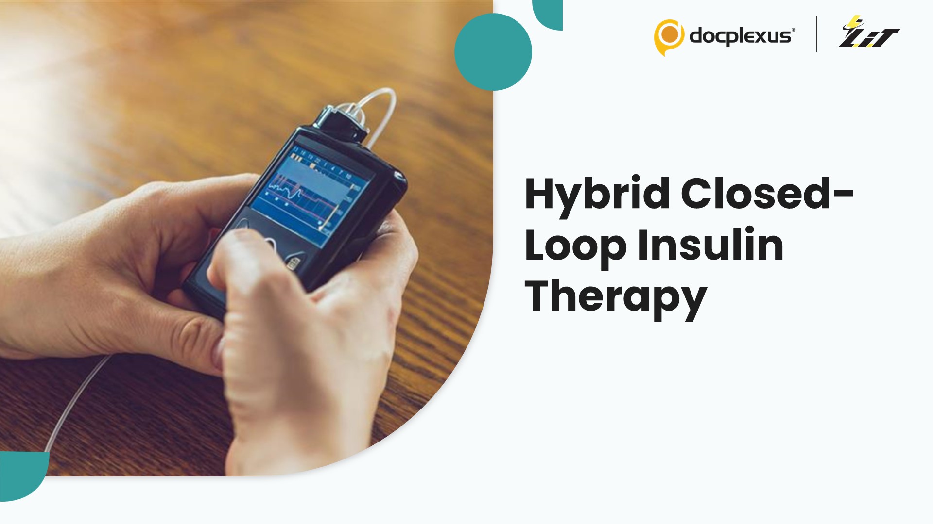 Hybrid Closed-Loop Insulin Therapy Linked to Better Diabetes Outcomes