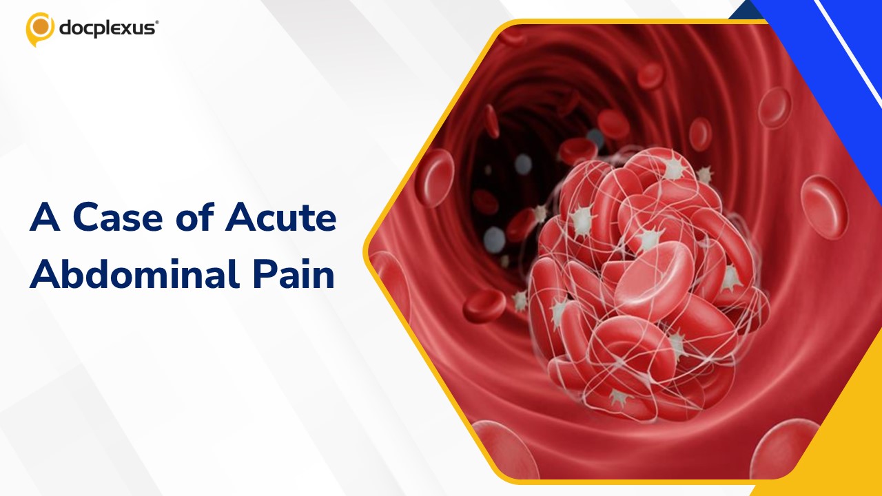 Diagnose This Patient with Rare Acute Abdominal Pain