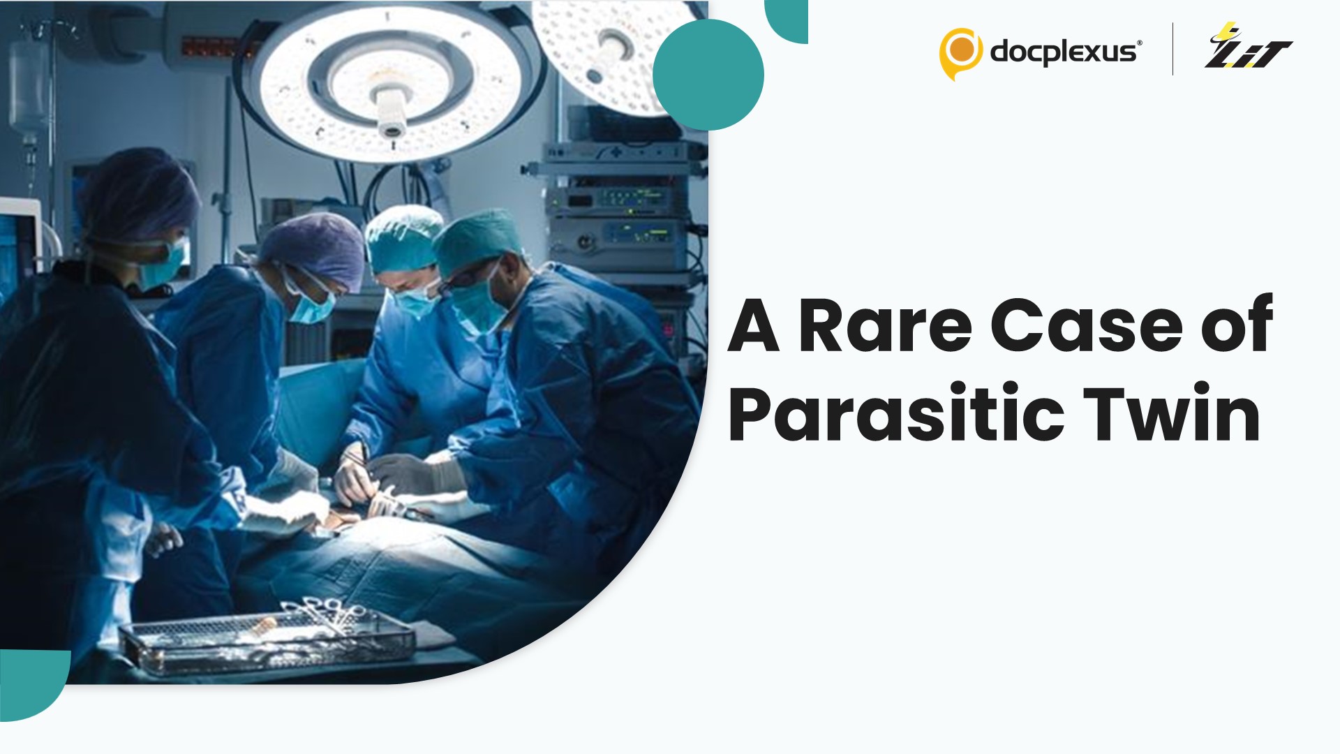 AIIMS Surgeons Separate Parasitic Twin Successfully