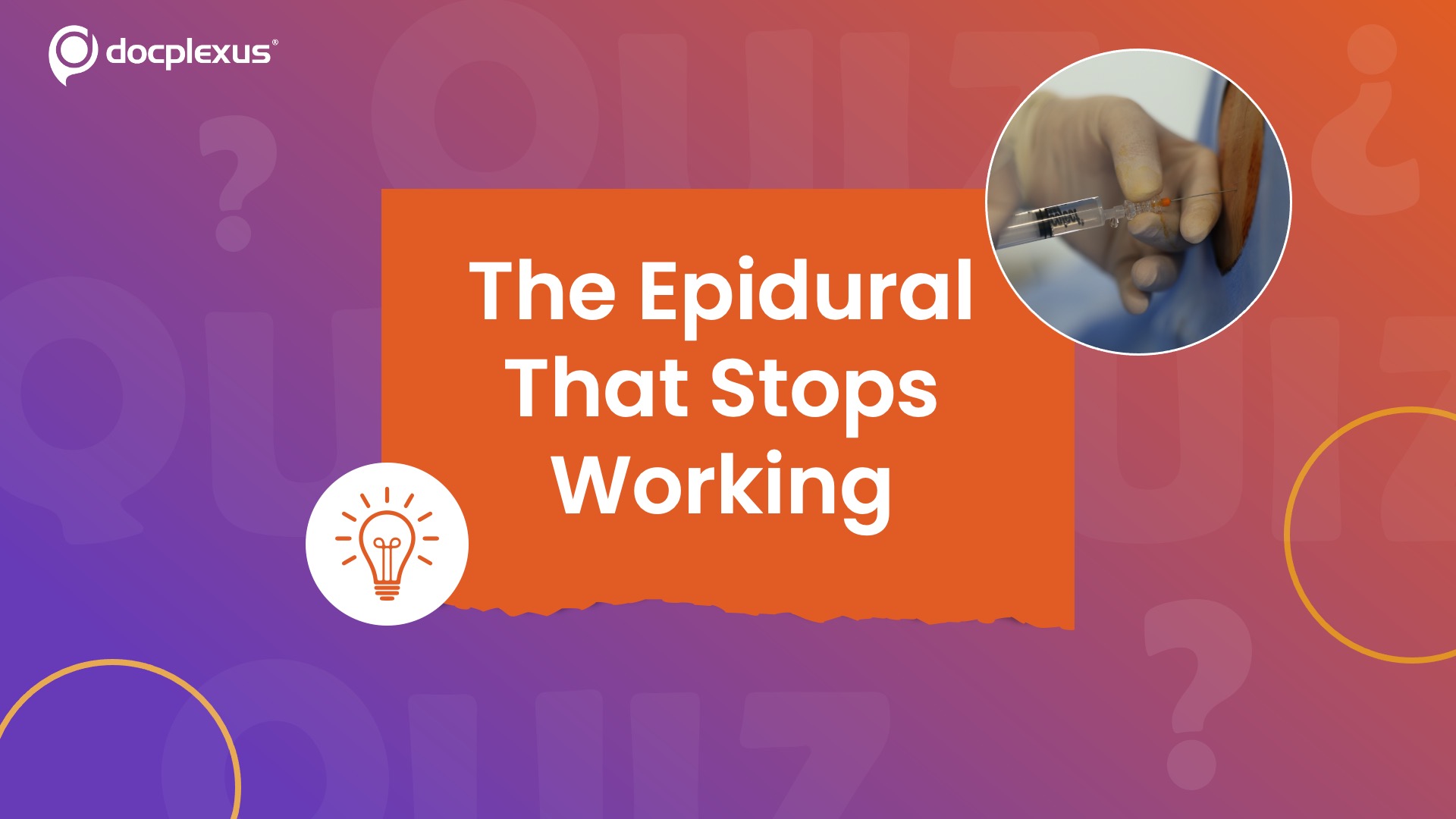 When Epidurals Fail Mid-Labor: Understanding Secondary Failure