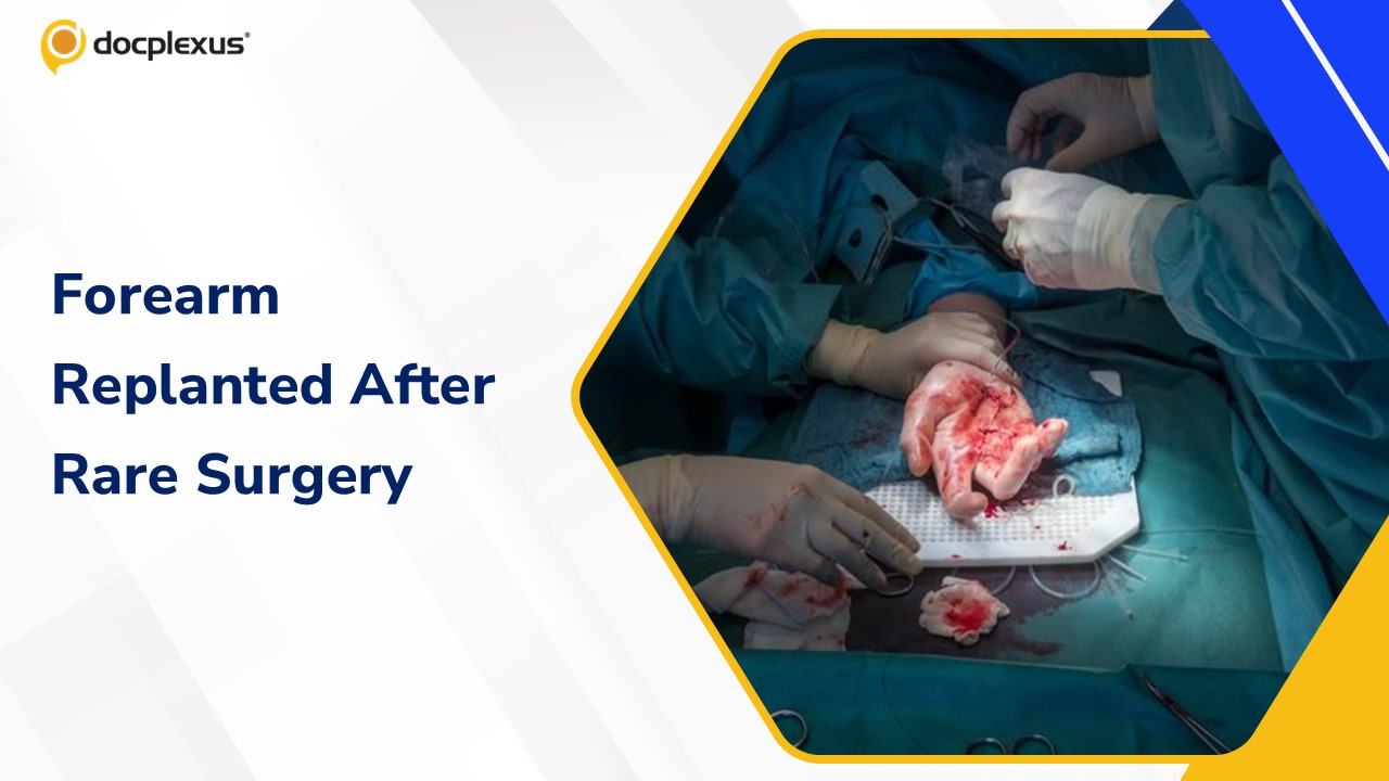 Severed Forearm Successfully Replanted After Rare Life-Saving Surgery