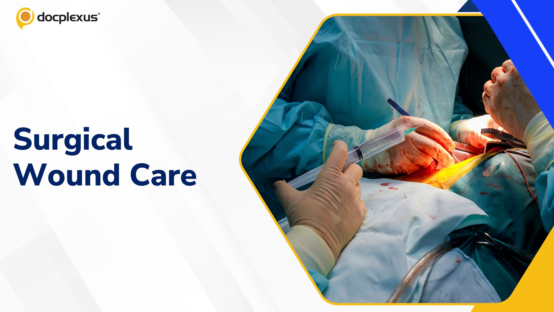 Prevention of Surgical Site Infections: Updated Guidance