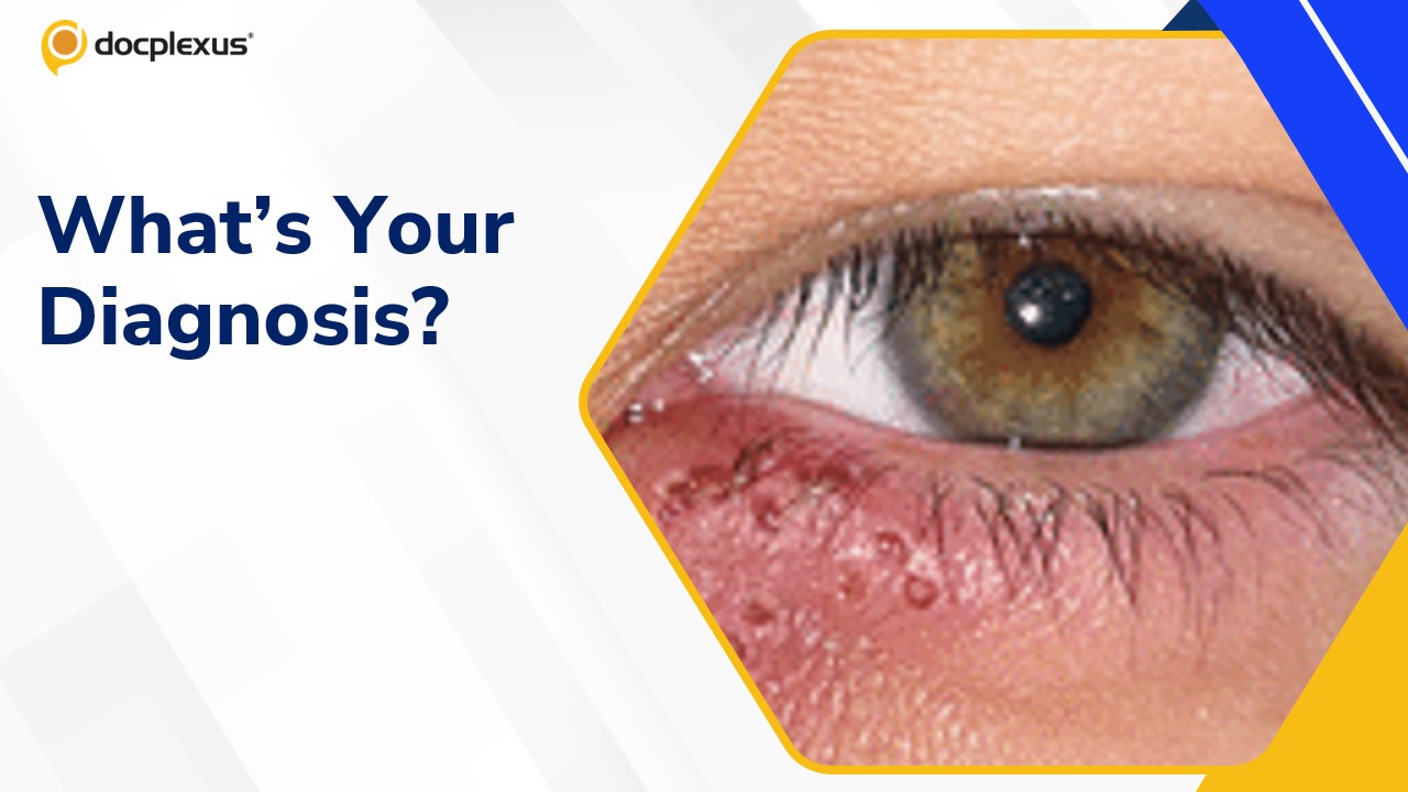 Guess the diagnosis