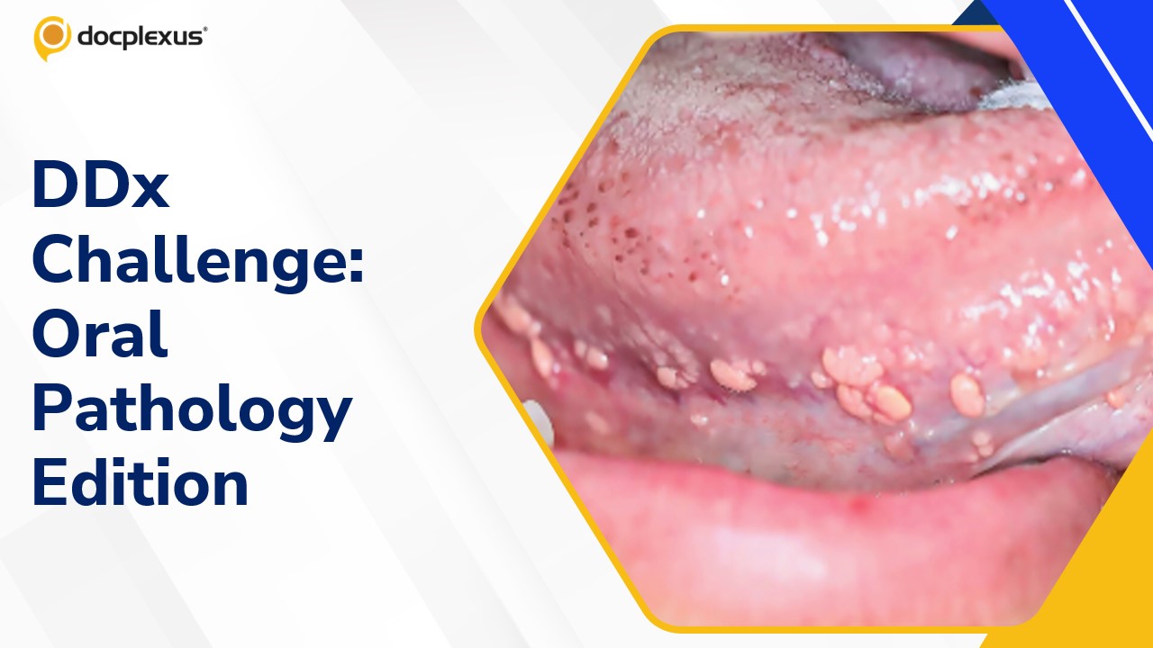 Differential diagnosis