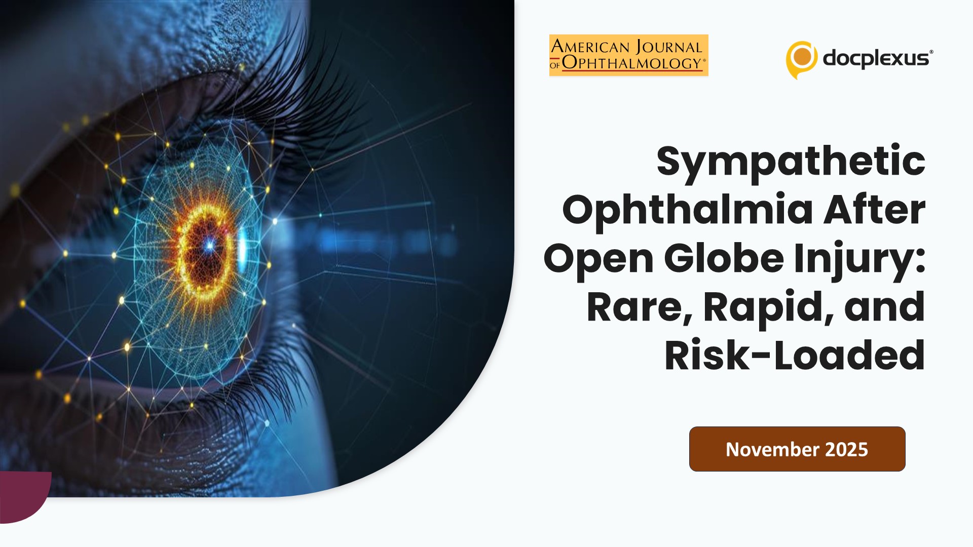 Sympathetic Ophthalmia After Open Globe Injury: Rare, Rapid, and Risk-Loaded
