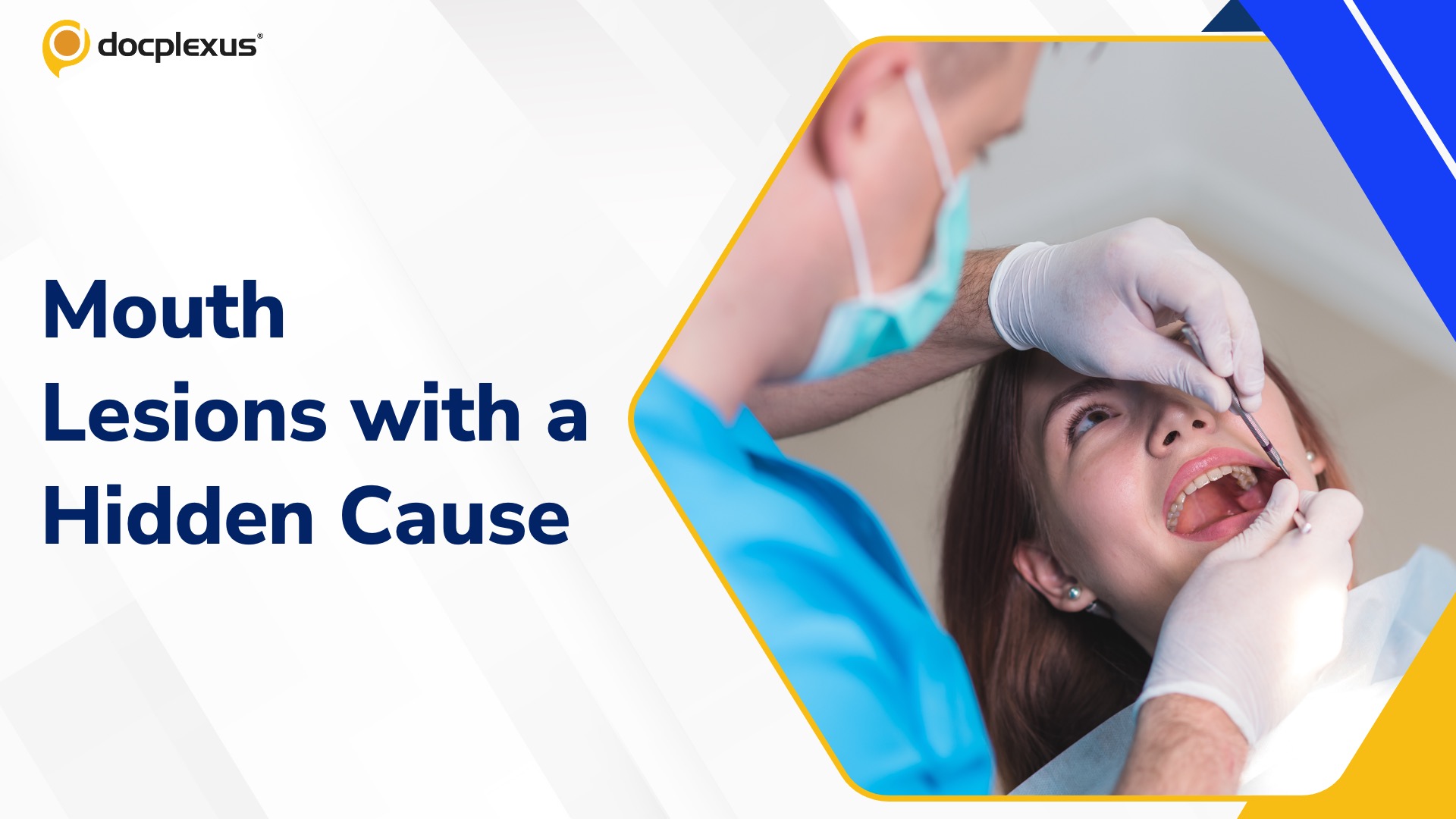 Persistent Oral Ulcers: A Diagnostic Puzzle