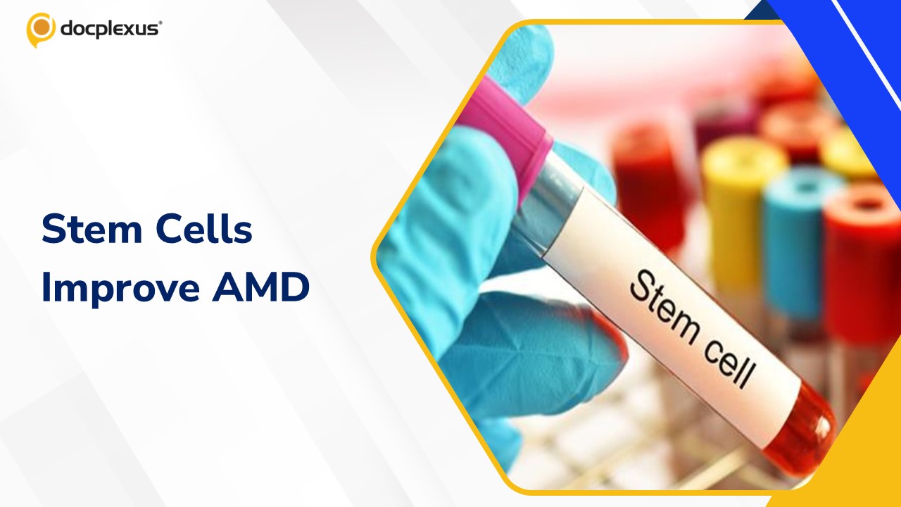 Stem Cell Trial Shows Promising Vision Gains for Advanced Macular Degeneration