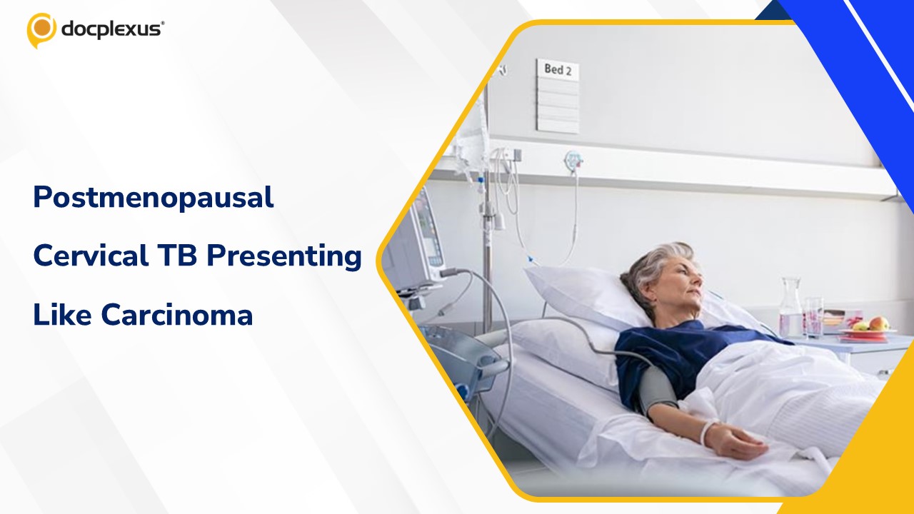 A Rare Case of Cervical Tuberculosis in the Postmenopausal Period Mimicking Carcinoma