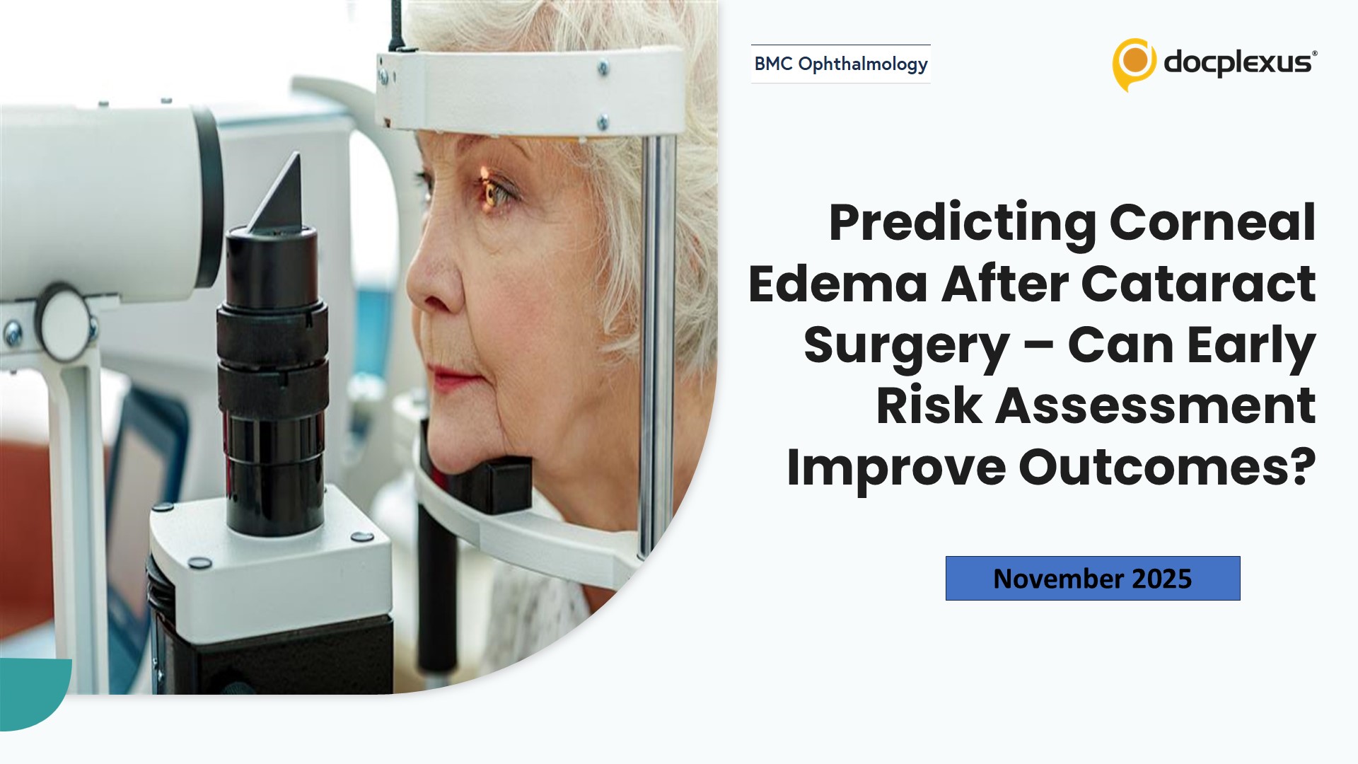 Predicting Corneal Edema After Cataract Surgery – Can Early Risk Assessment Improve Outcomes?