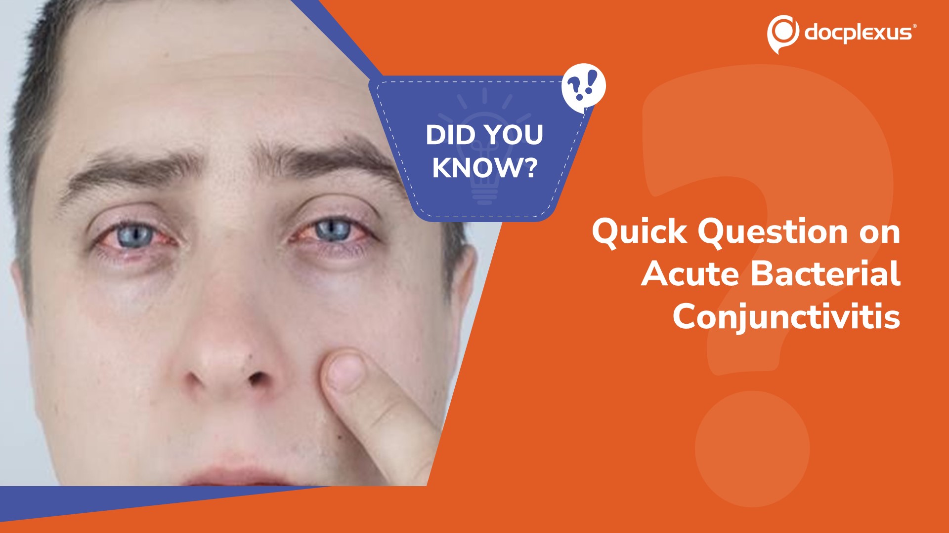 Acute Bacterial Conjunctivitis: Key Insight & Quick Quiz