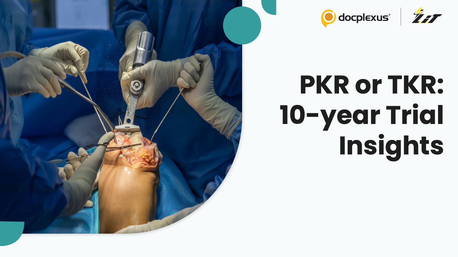 PKR vs TKR: Unpacking a Decade of Knee Arthroplasty Evidence