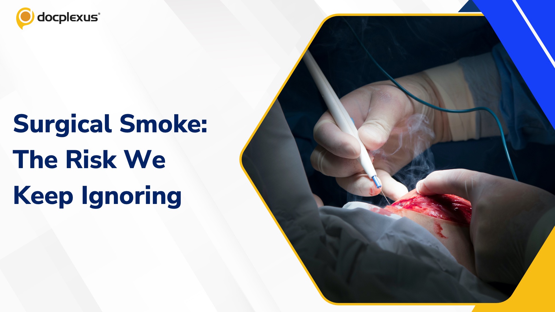 Surgical Smoke: Sources, Risks, and Protective Measures