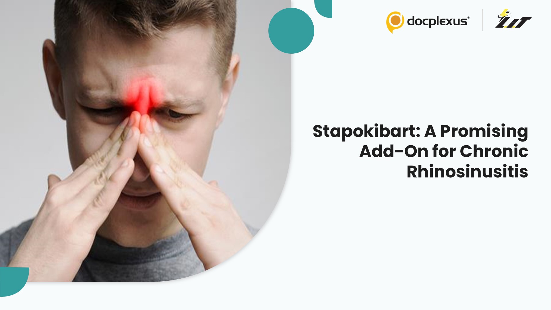 Stapokibart as an Adjunct Therapy: Improving Outcomes in Chronic Rhinosinusitis with Nasal Polyps