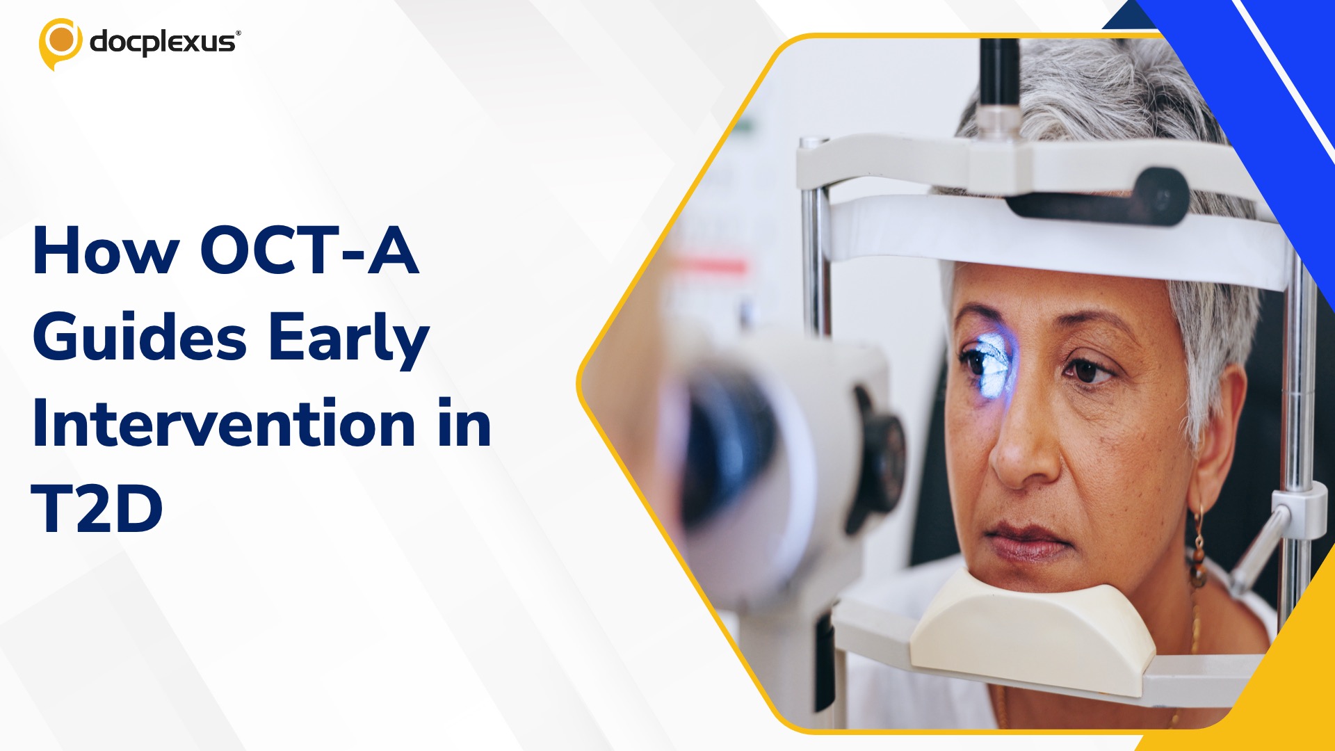 Seeing the Unseen: OCT-A Indicators of Early Diabetic Microangiopathy