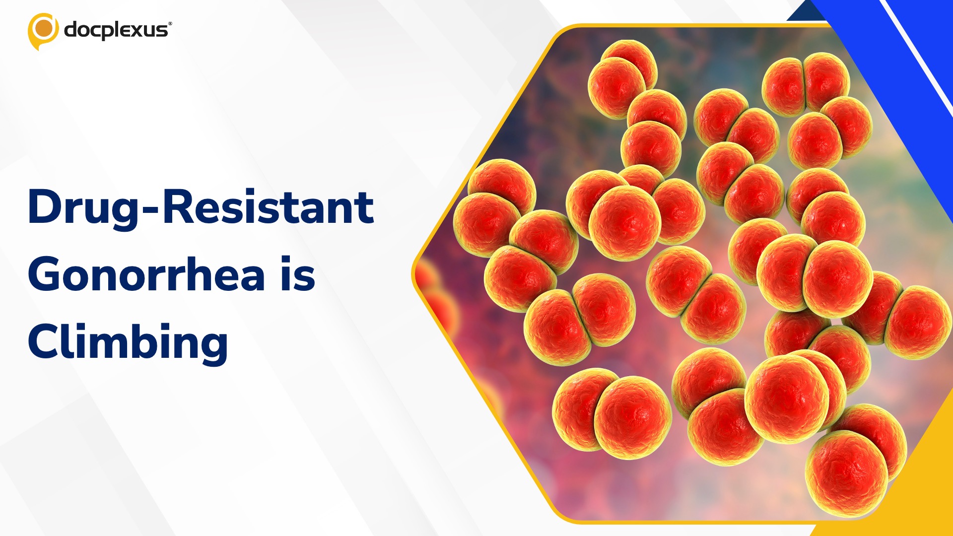 Rising Drug-Resistant Gonorrhea: New WHO Data Rings Global Alarm