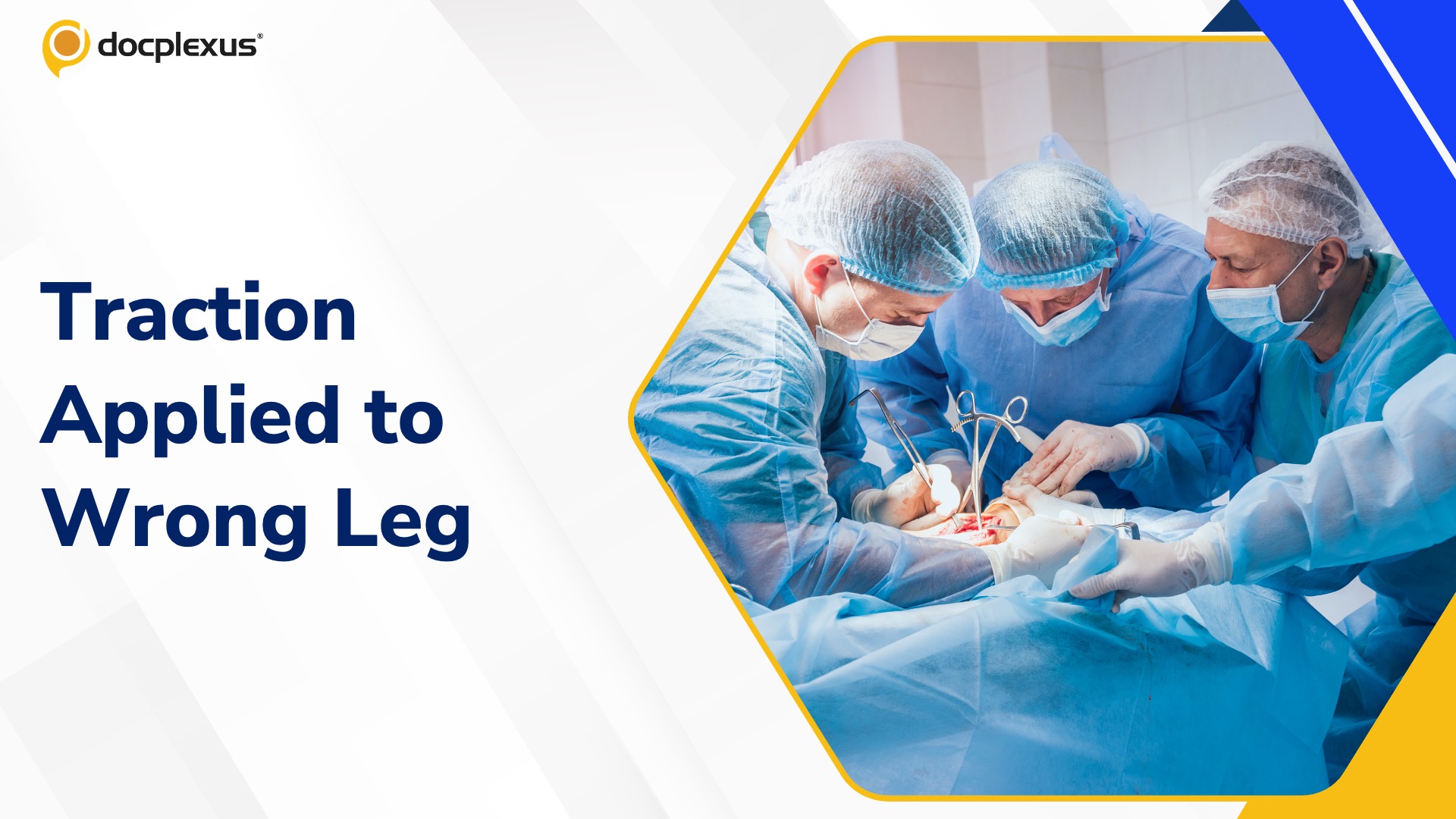 Wrong Leg Traction Triggers Probe