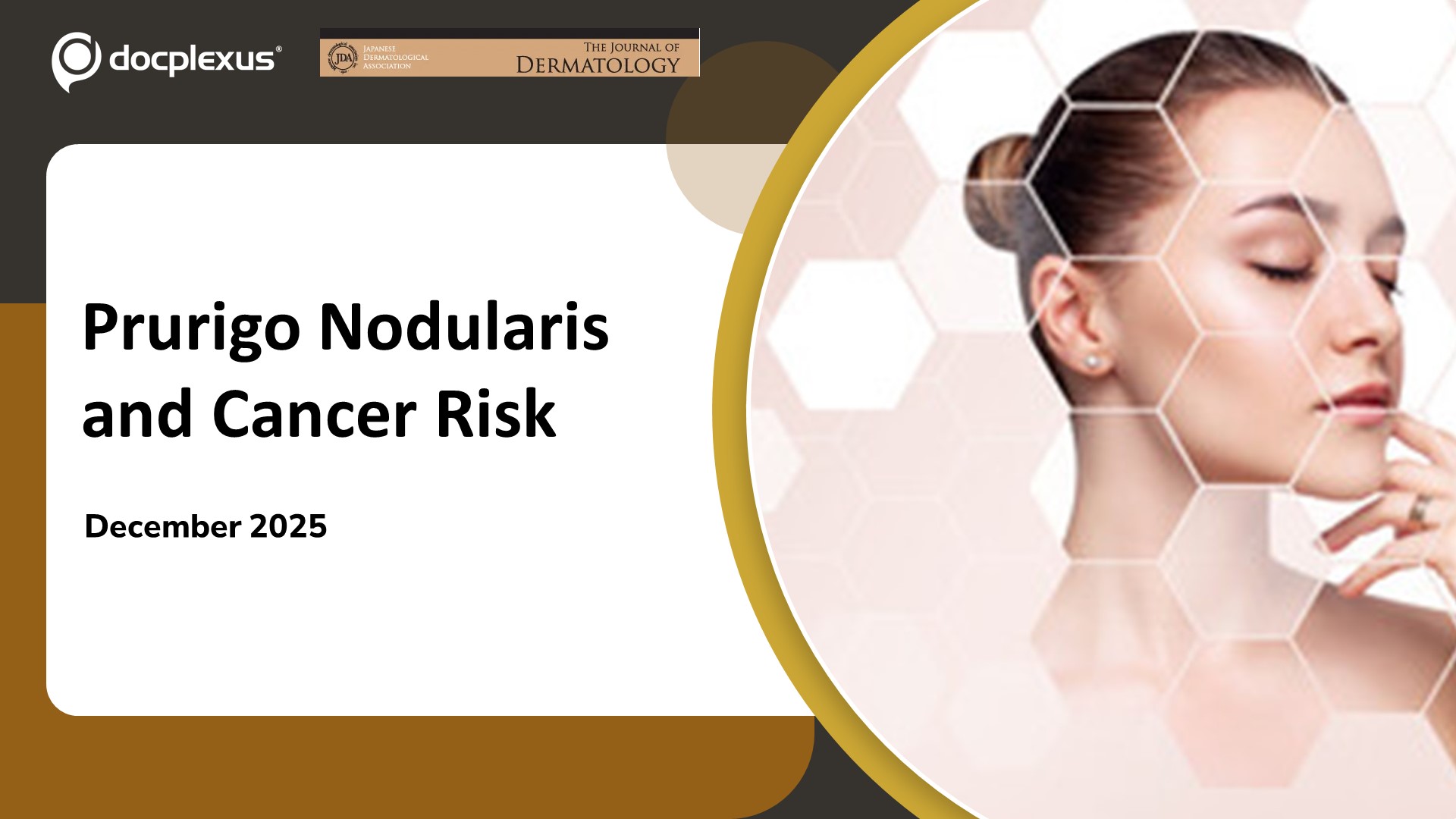 When Nodules Signal More: Prurigo Nodularis Linked to Higher Malignancy Risk