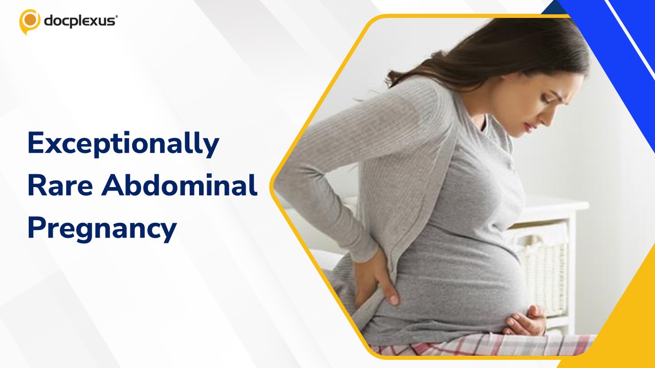 Rare Full-Term Abdominal Pregnancy Delivered During 22-Pound Cyst Removal