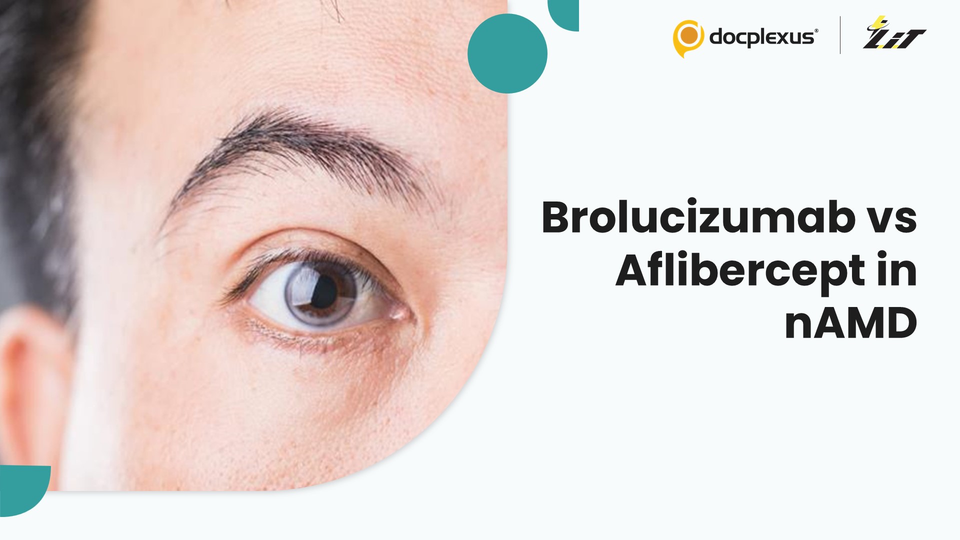 Brolucizumab Versus Aflibercept in Neovascular AMD Management