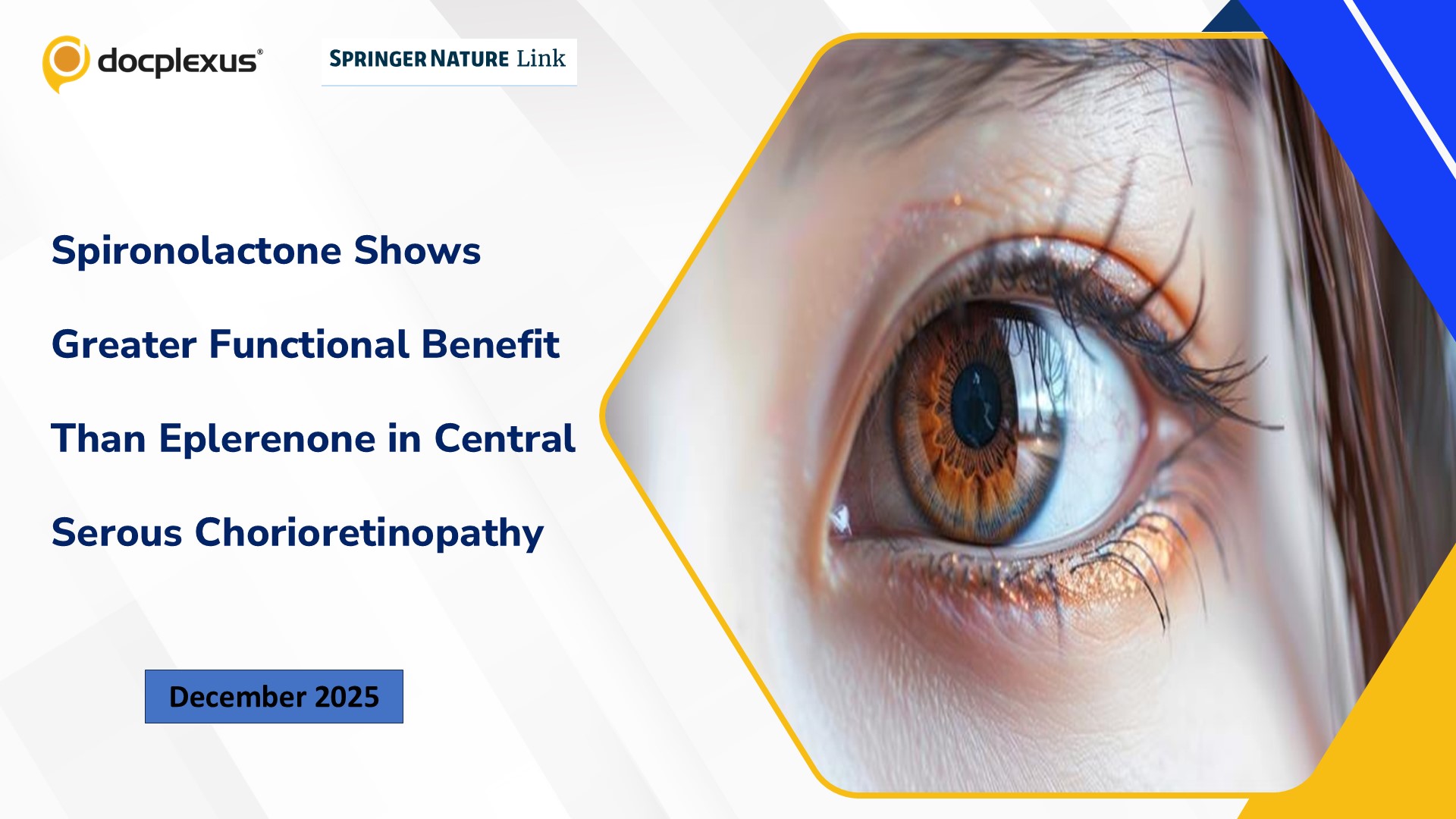 Spironolactone Shows Greater Functional Benefit Than Eplerenone in Central Serous Chorioretinopathy