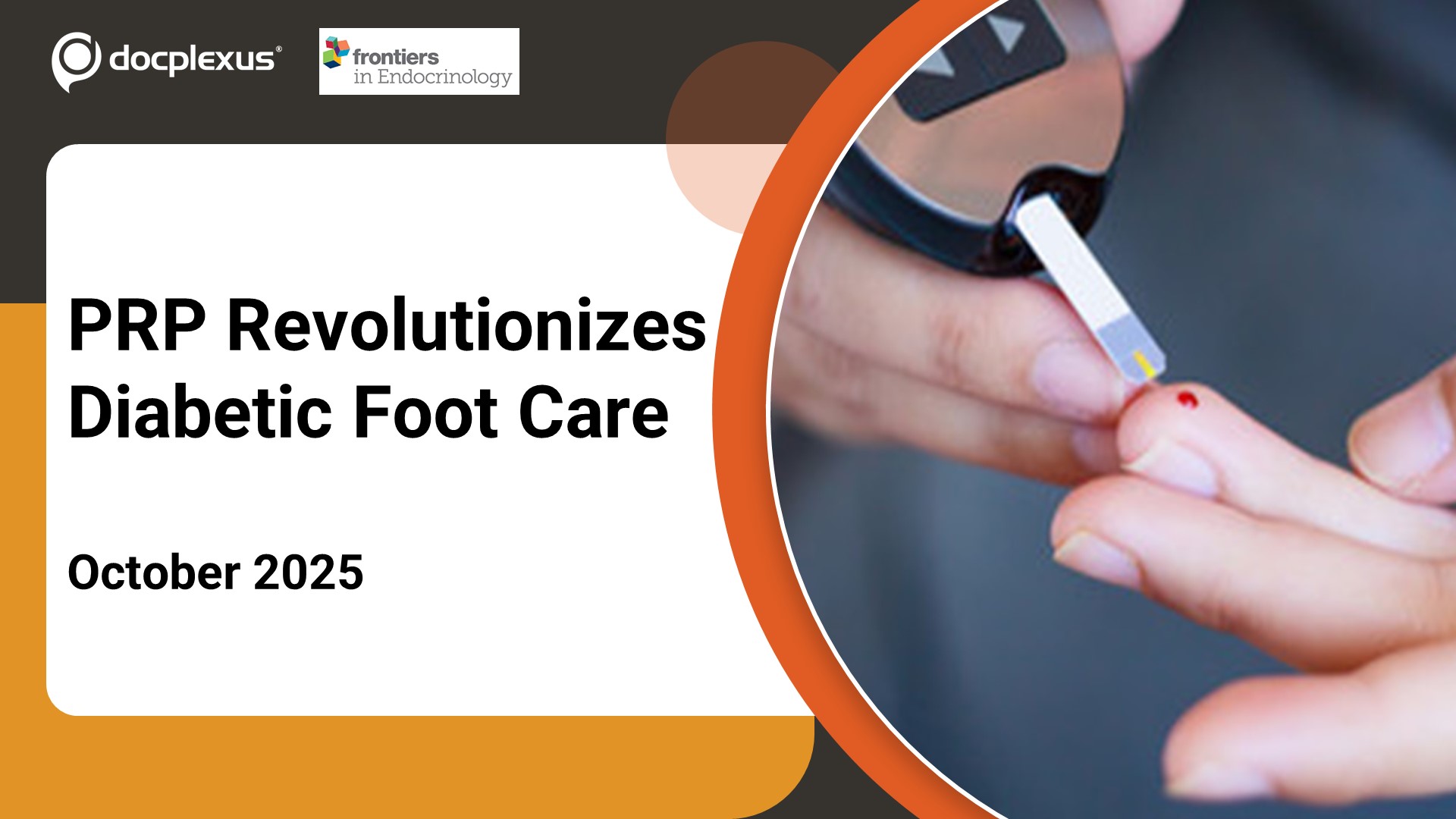 Allogeneic PRP Shows Breakthrough Healing in Diabetic Foot