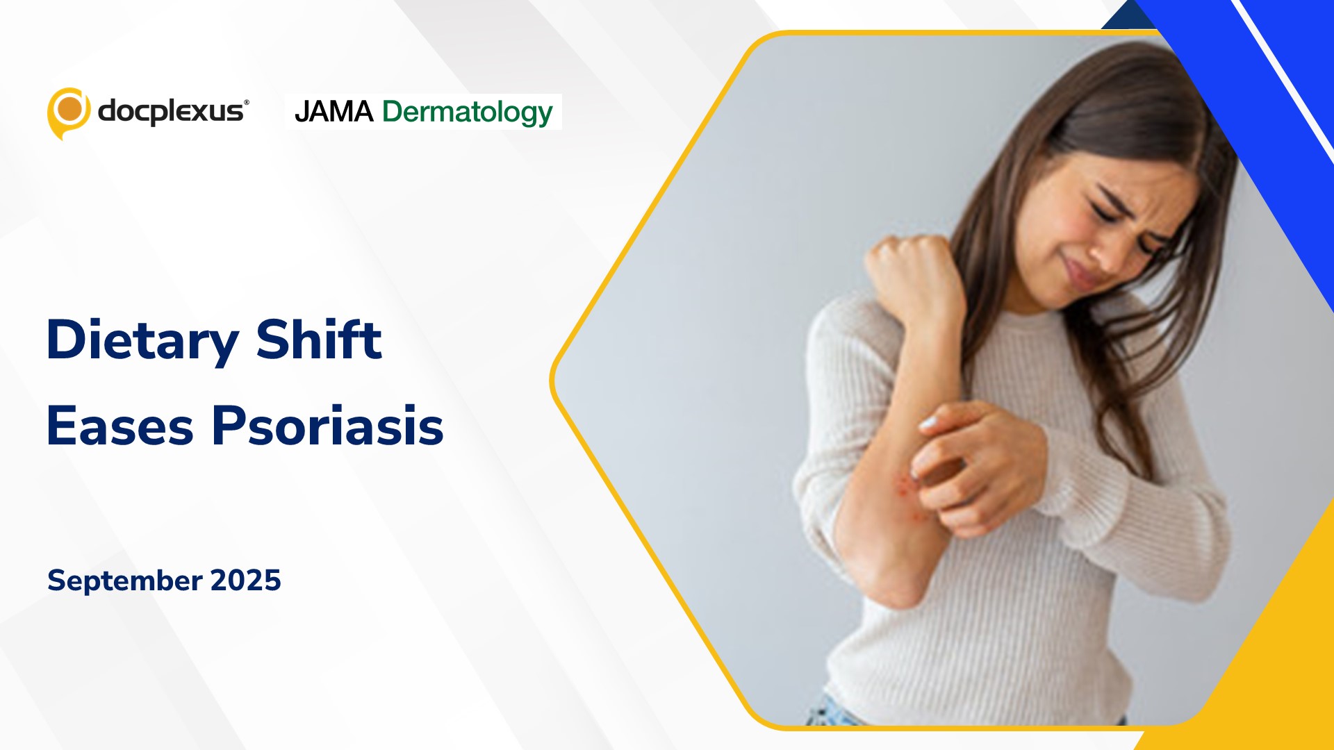 Mediterranean Diet Tames Psoriasis Inflammation and Flares