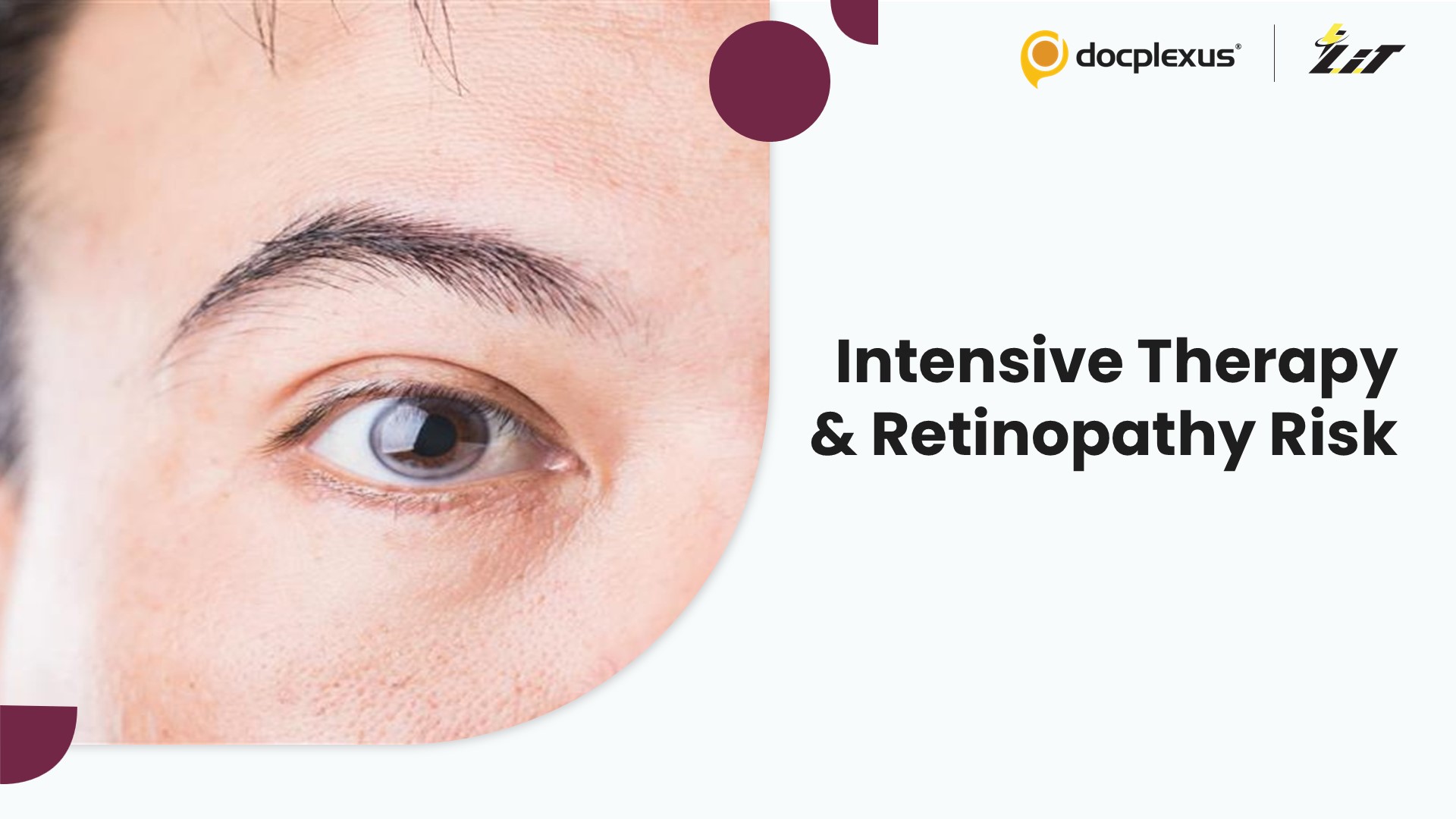 Impact of Intensive Multifactorial Therapy on Retinopathy in Type 2 Diabetes