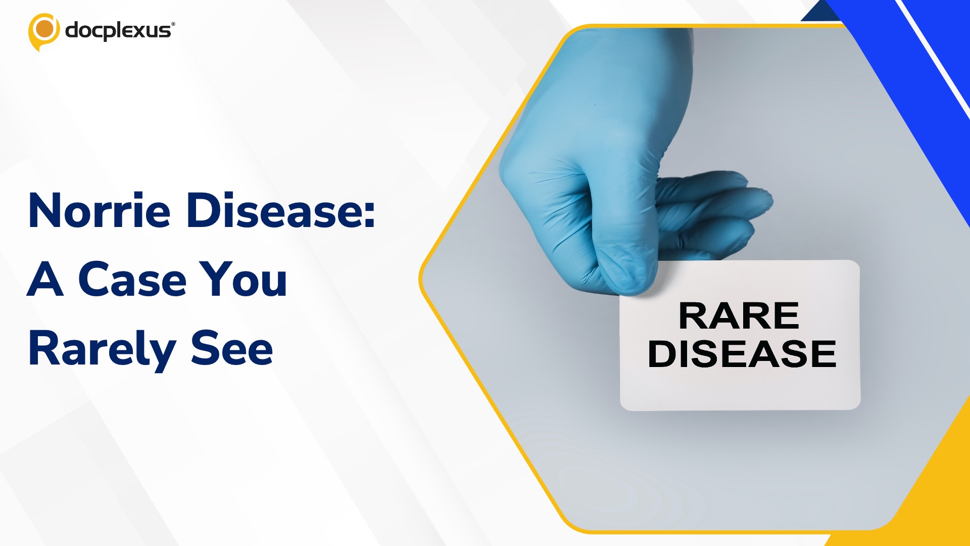 Norrie Disease: A Rare-Disease Story Every Clinician Should Know