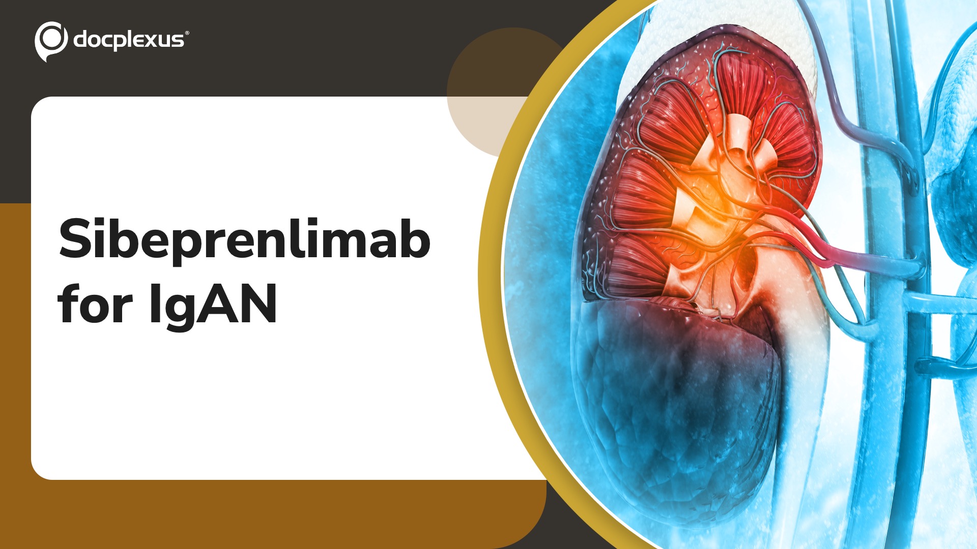 US FDA Approves Sibeprenlimab for Primary Immunoglobulin A Nephropathy