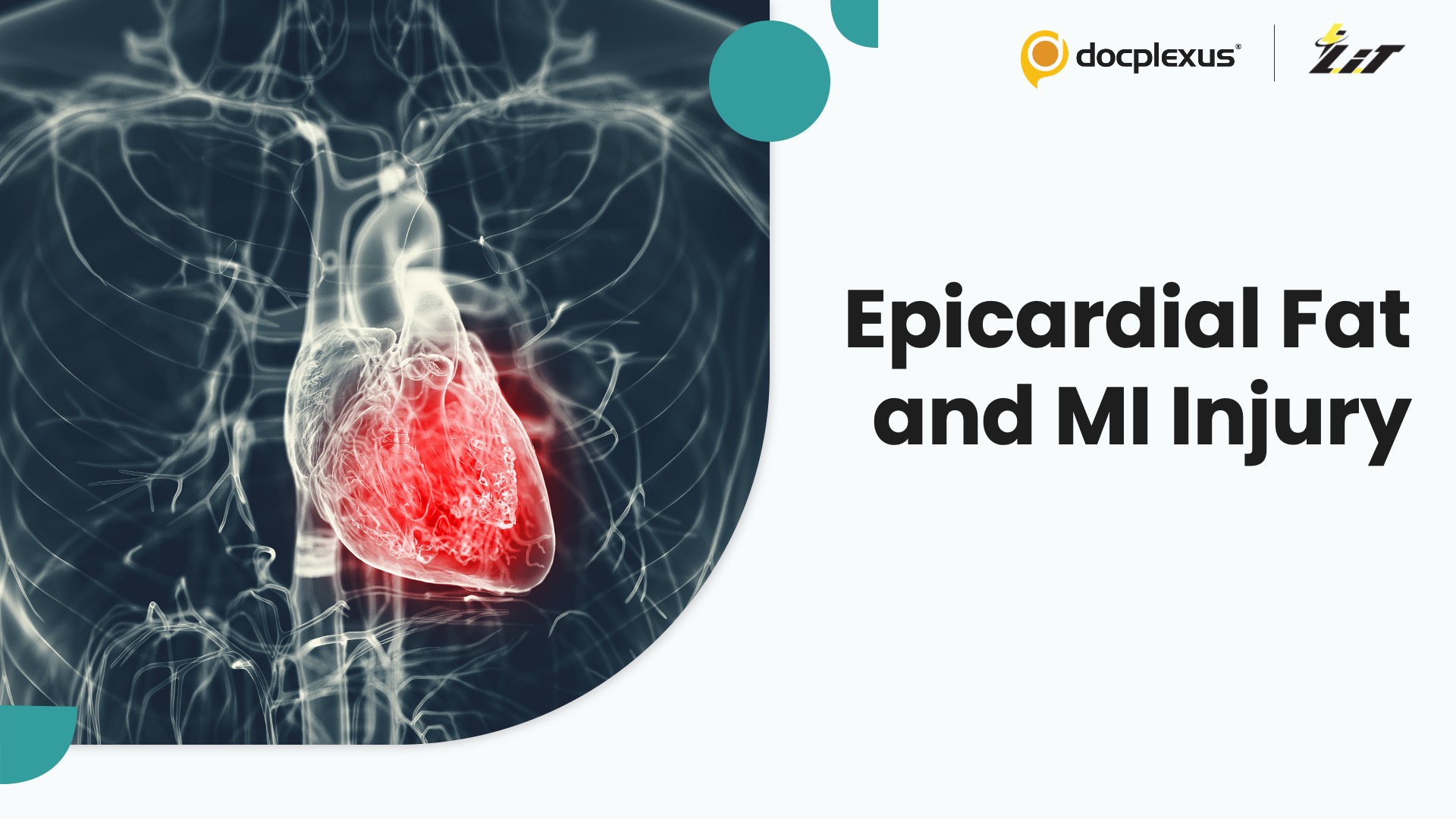 Epicardial Fat Volume Tied to Greater Myocardial Injury After Infarction