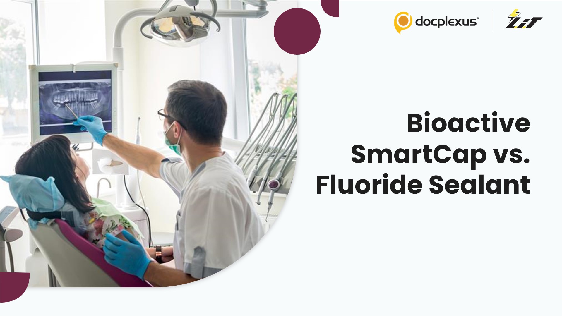 Bioactive SmartCap vs. Fluoride-Releasing Sealant in Adult Occlusal Caries