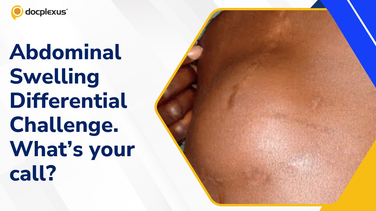 Guess the Diagnosis: What’s Behind the Midline Lump?