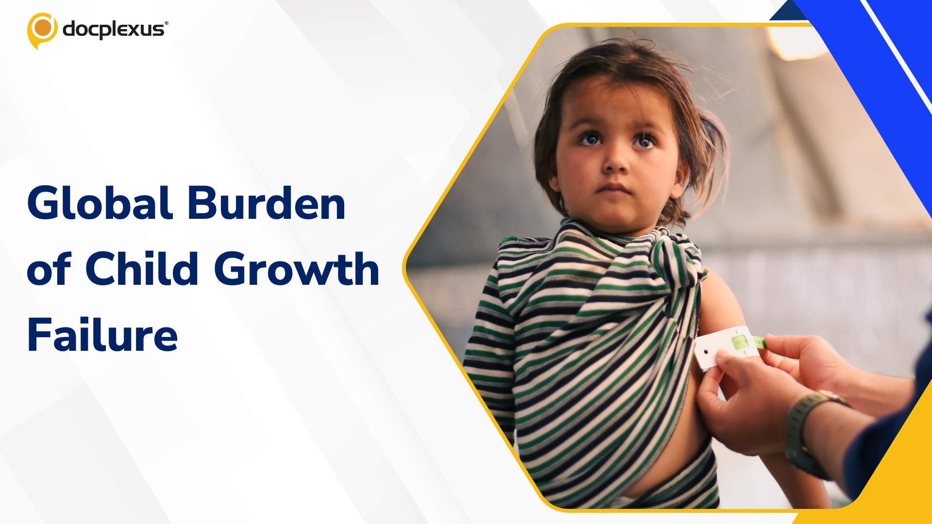 Child Growth Failure: A Persistent Global Challenge with Uneven Progress