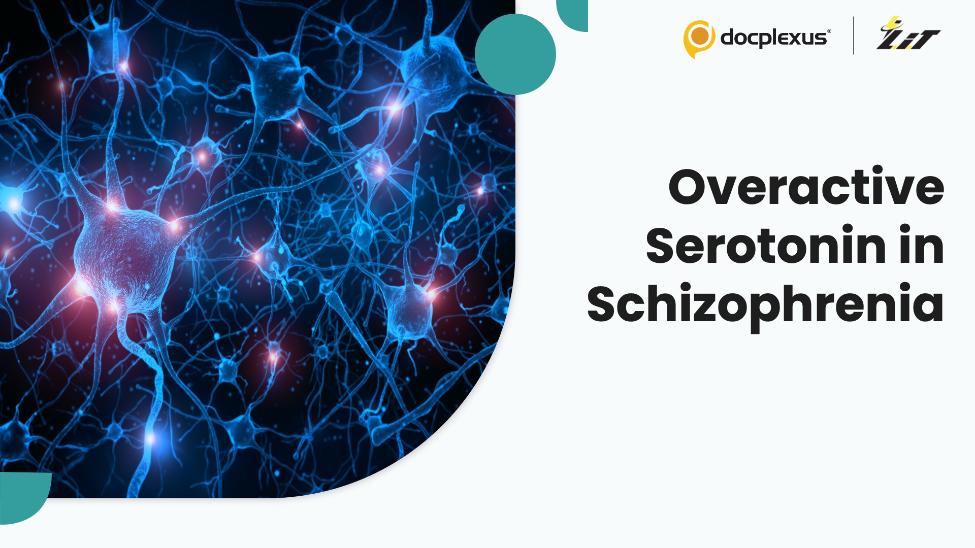 Schizophrenia Linked to Excess Serotonin Release in the Frontal Cortex
