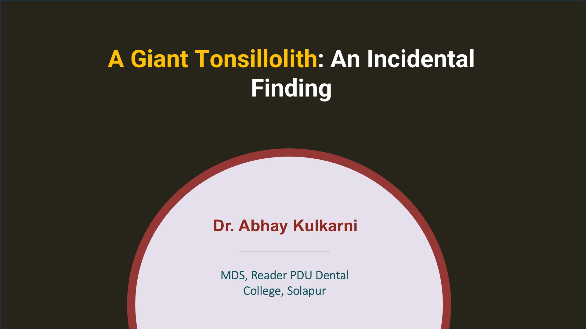 A Giant Tonsillolith: An Incidental Finding