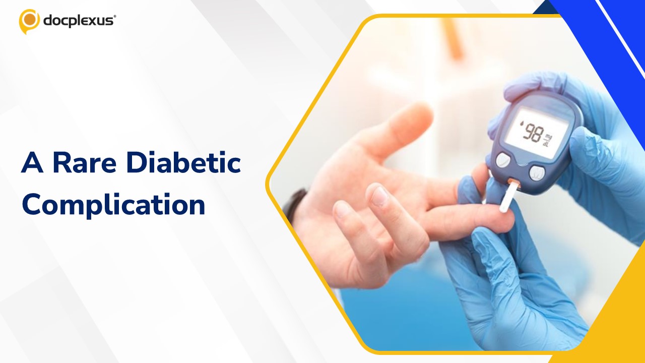 Diagnose This Rare Diabetic Complication