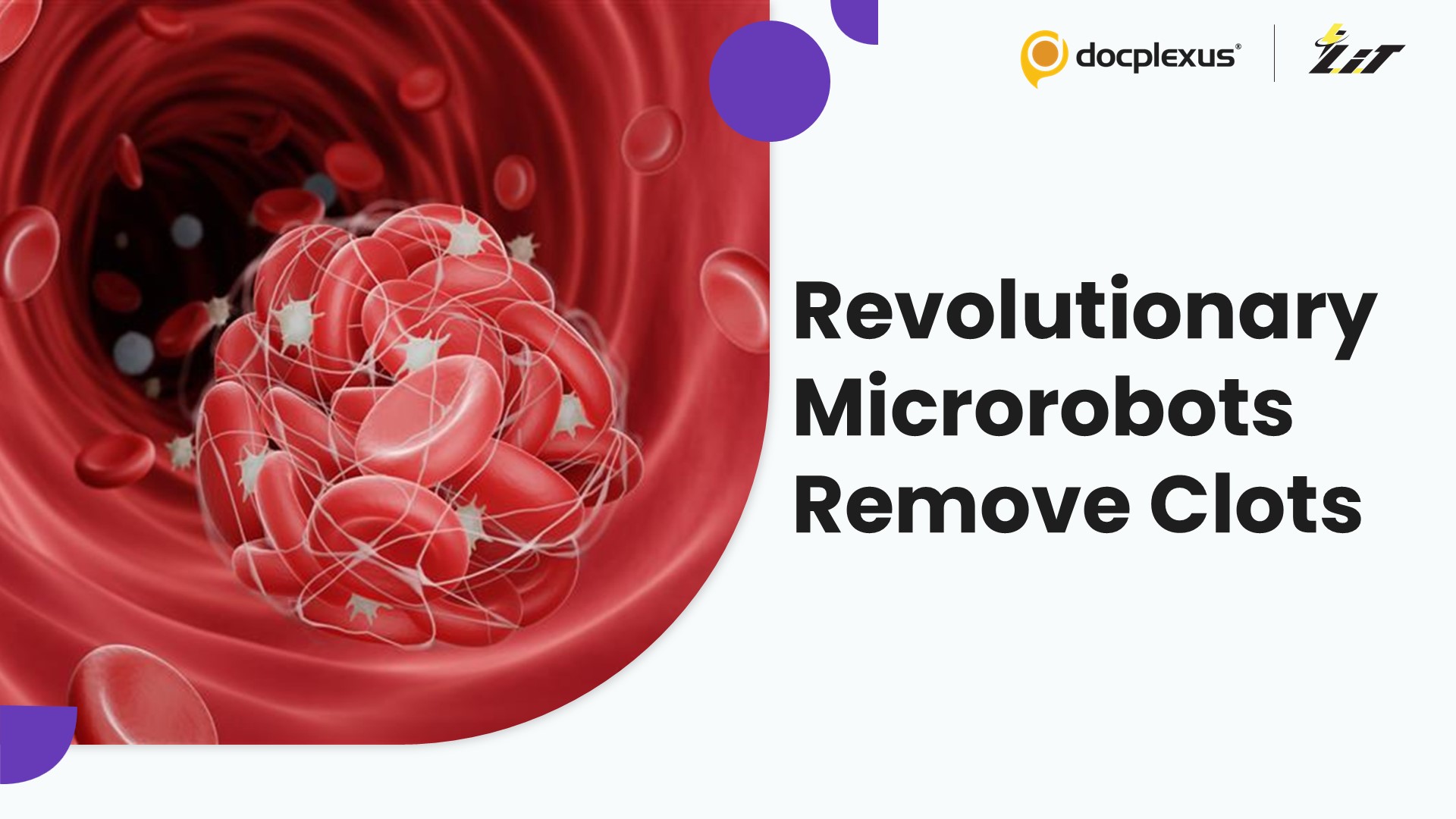 Wireless Magnetic Microrobots Successfully Remove Blood Clots