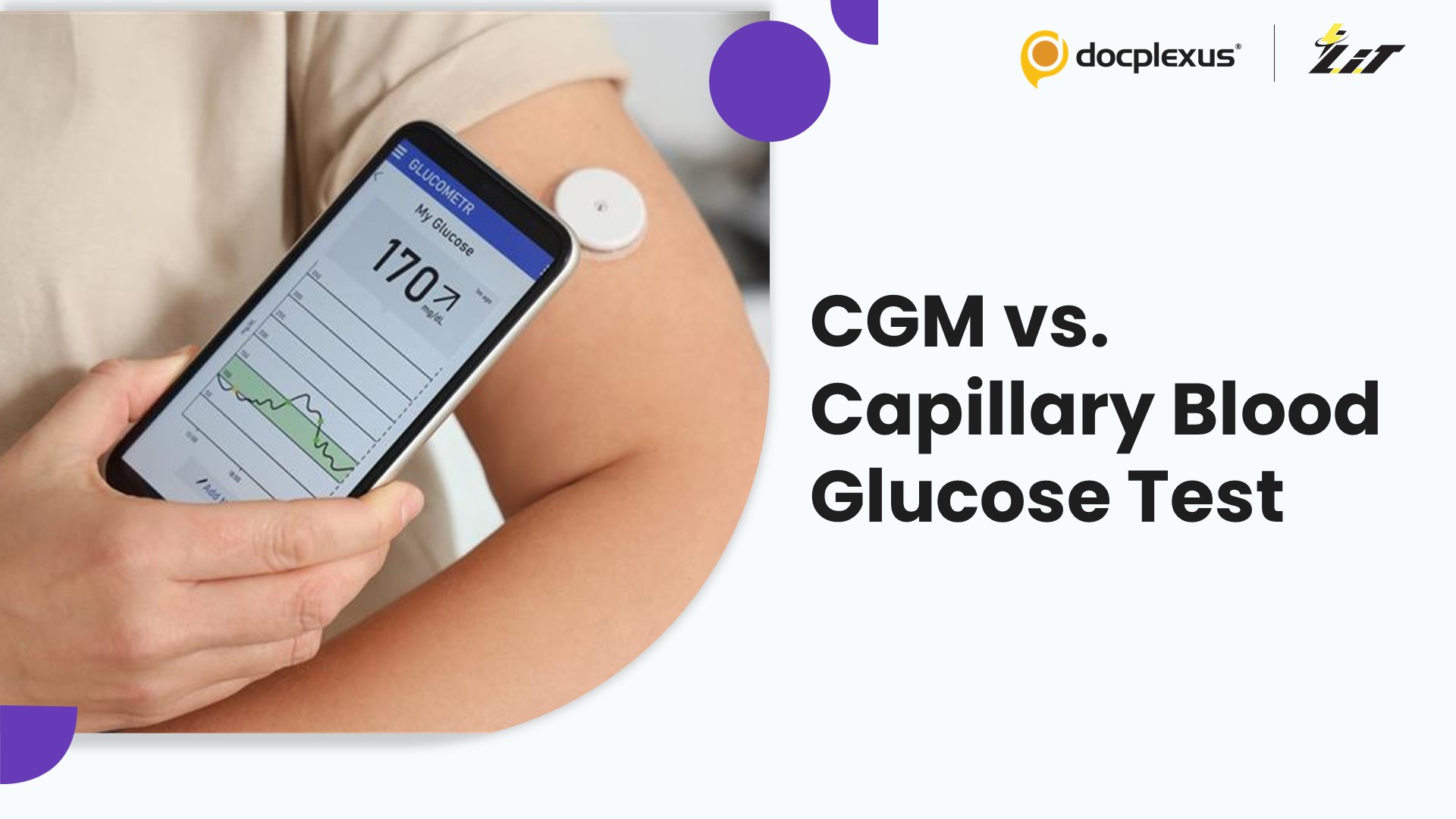 Continuous Glucose Monitors Overestimate Blood Glucose Levels