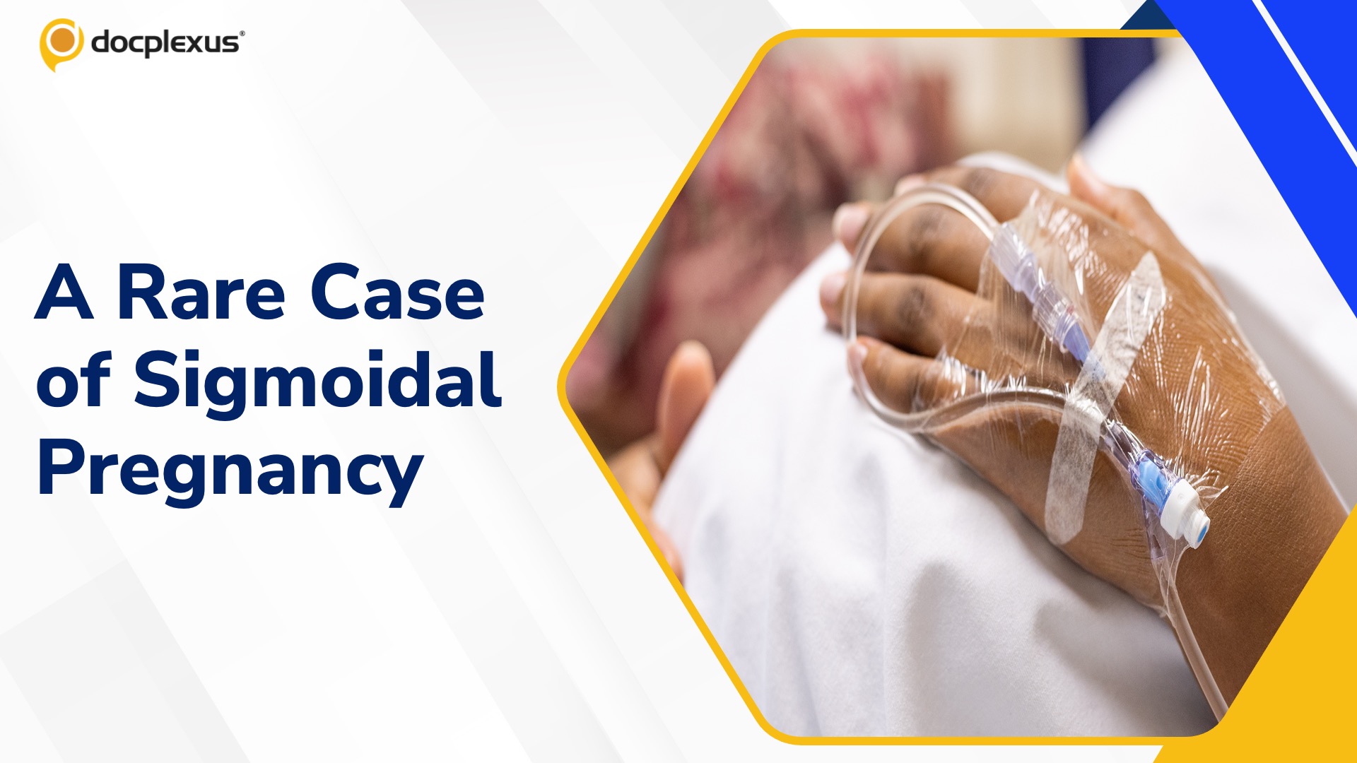 Complications of Sigmoidal Pregnancy: A Case Study
