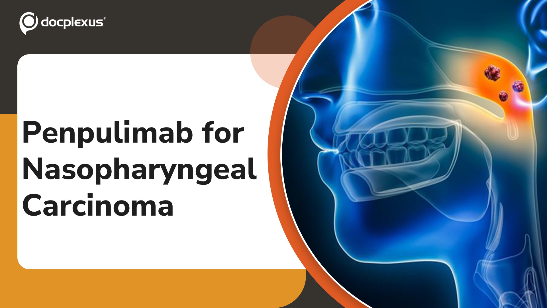 USFDA Approves Penpulimab-kcqx for Nasopharyngeal Carcinoma