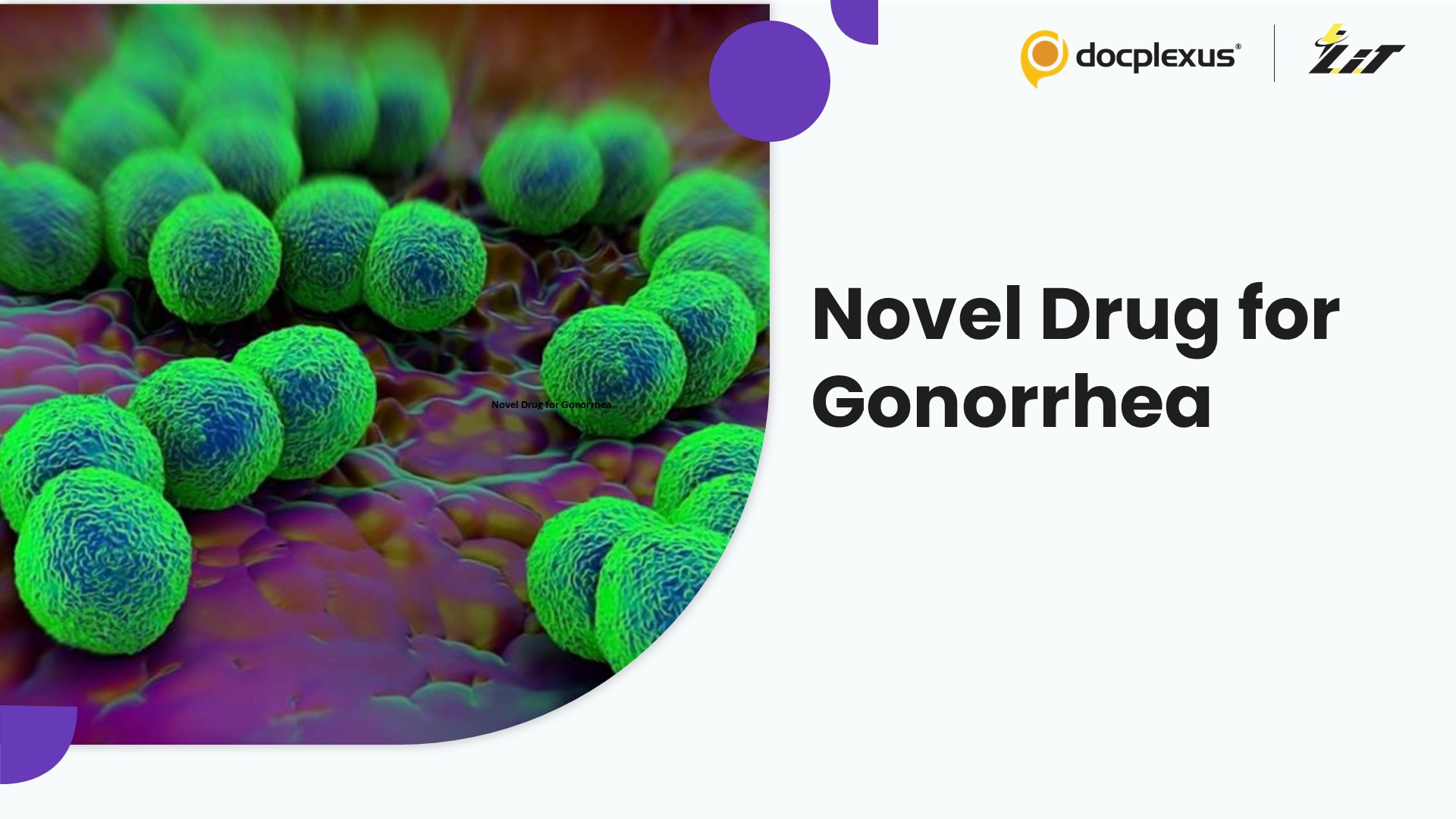 Gepotidacin Found Effective Against Gonorrhea