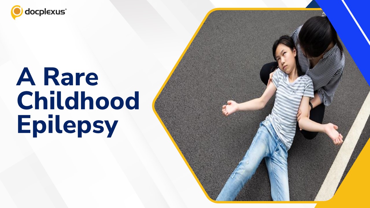 Dravet Syndrome: A Severe Form of Childhood Epilepsy