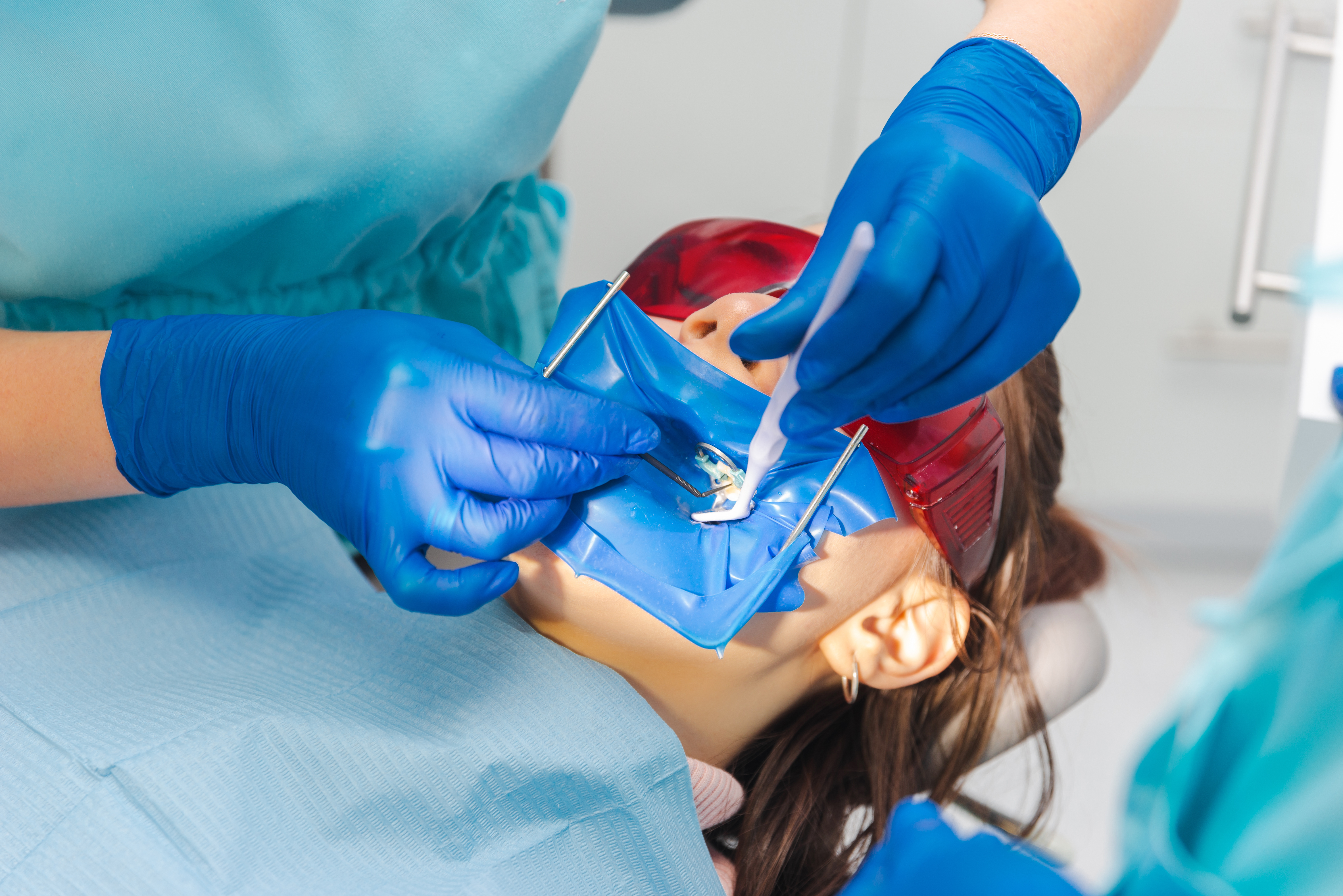 Rubber Dam for Occlusal Fillings & RCT