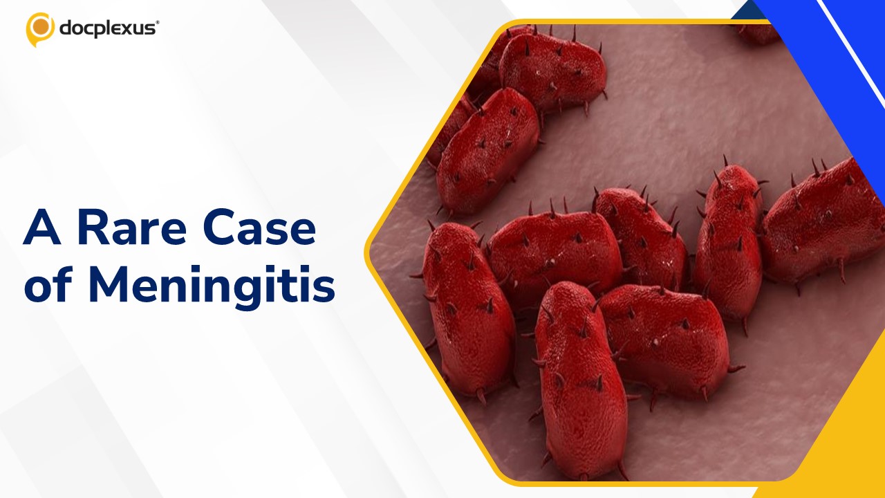Diagnose This Rare Case of Meningitis