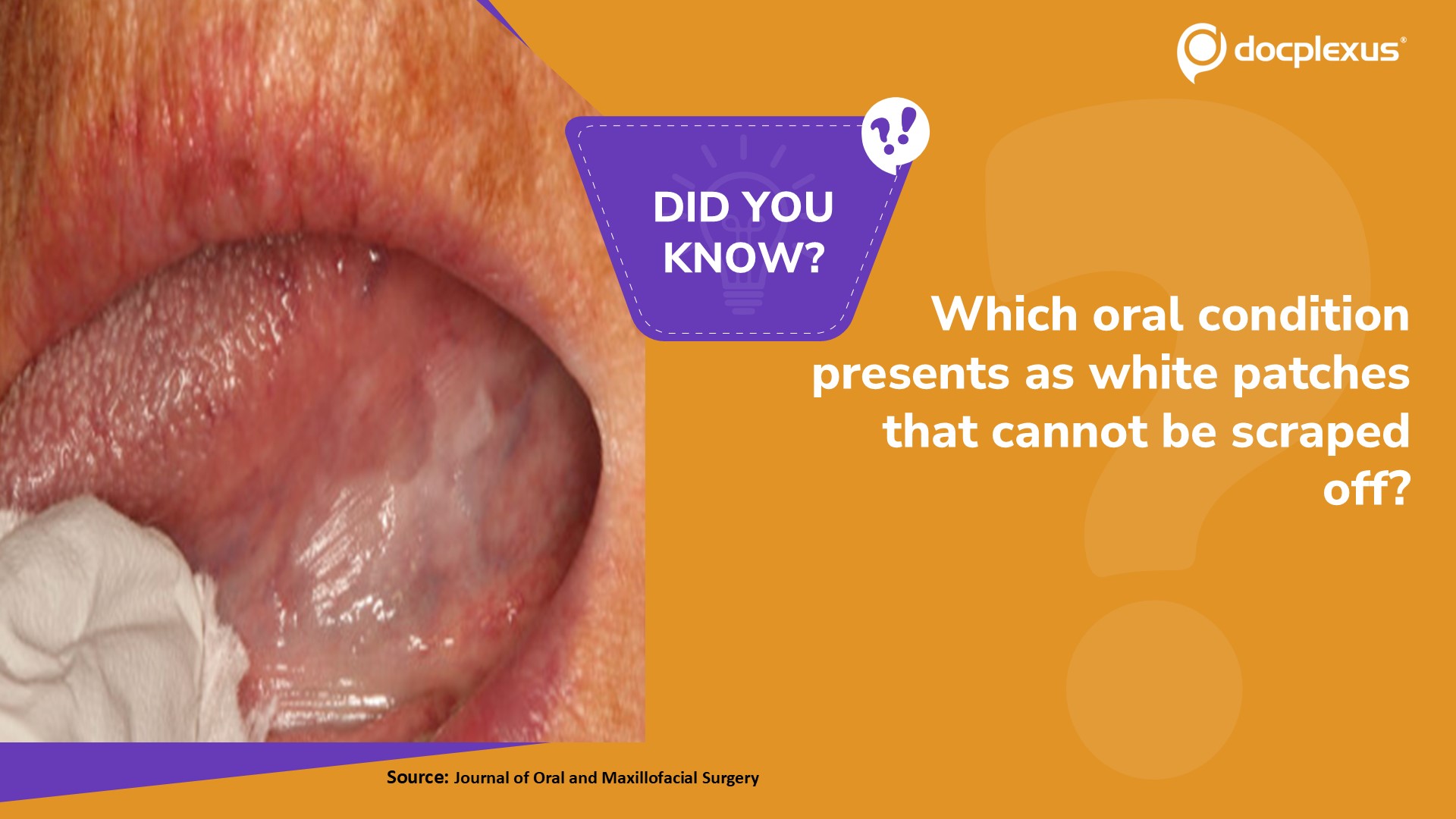 Identify the Oral Condition That Presents as White Patches That Cannot be Scraped Off