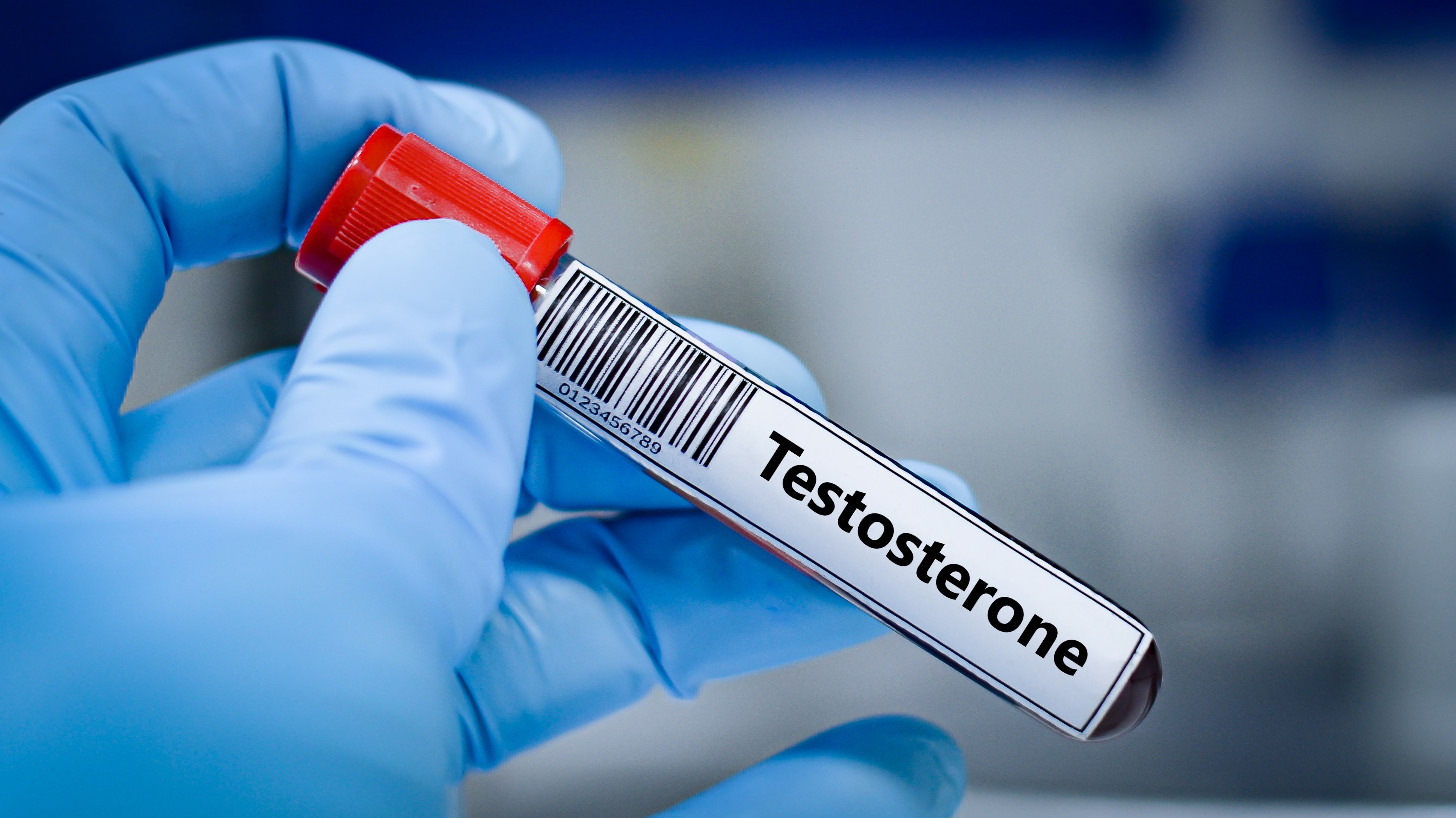 Counselling for Testosterone Therapy in Mid Life Men