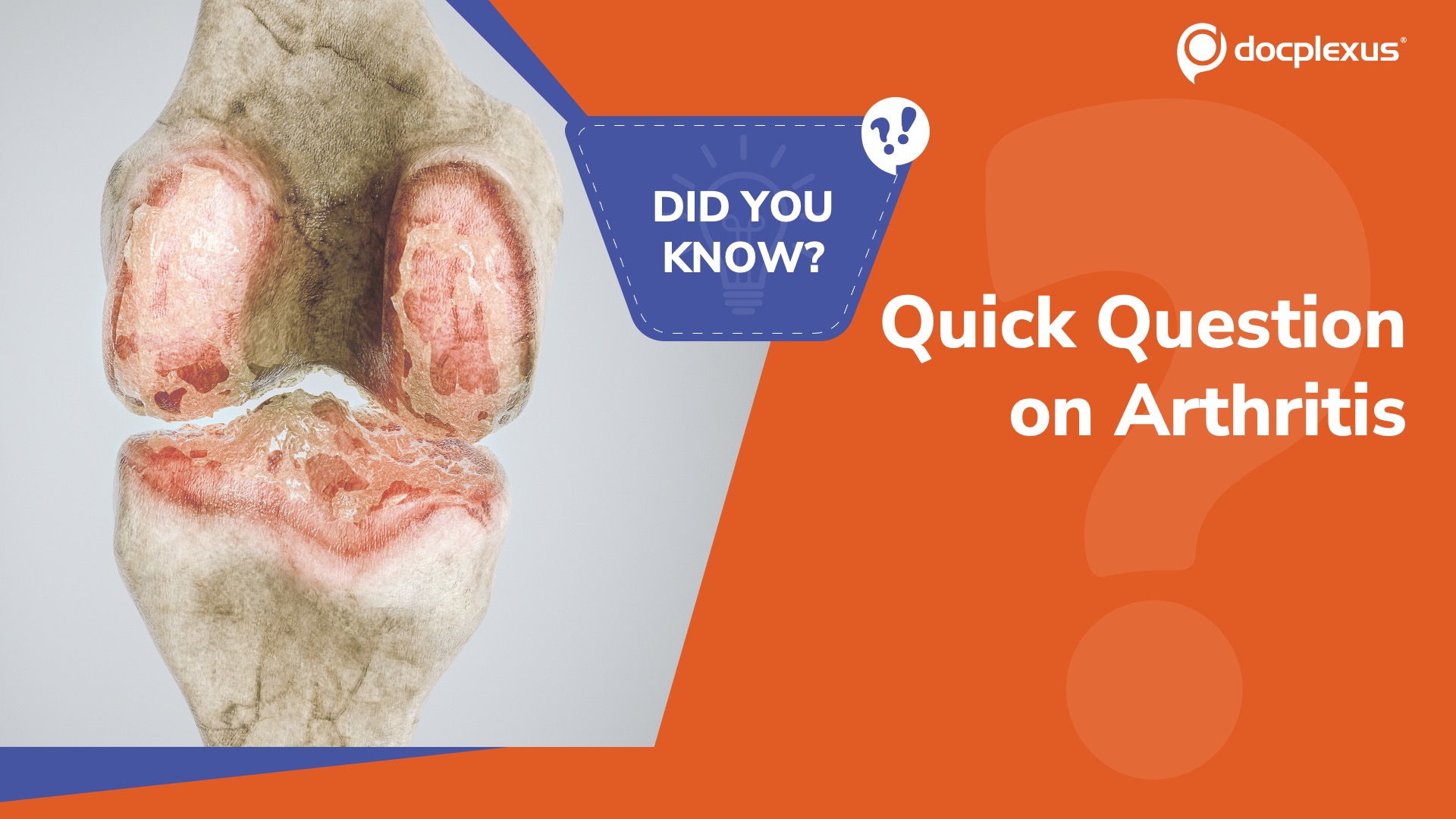 Arthritis Awareness Month: How Well Do You Know Osteoarthritis?