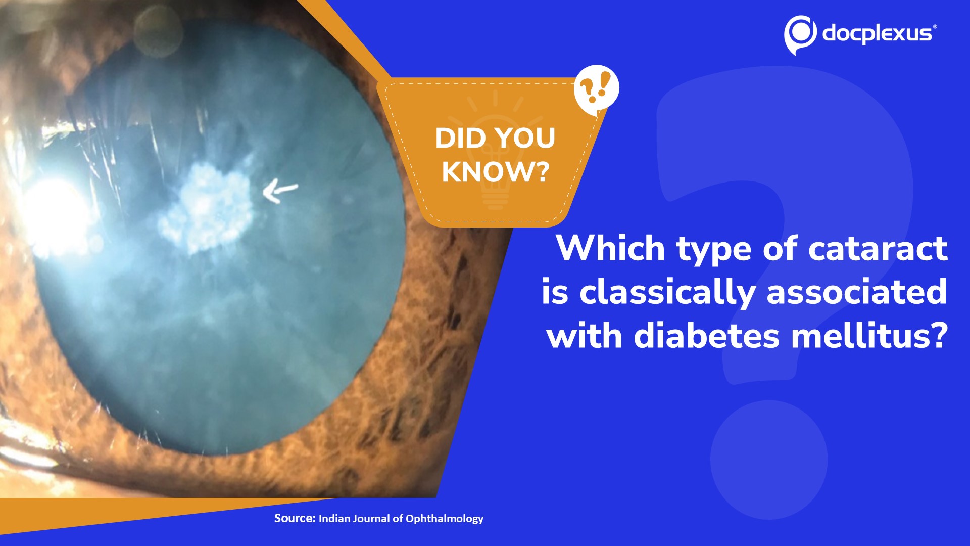 Can You Identify the Type of Cataract Classically Associated with Diabetes Mellitus?